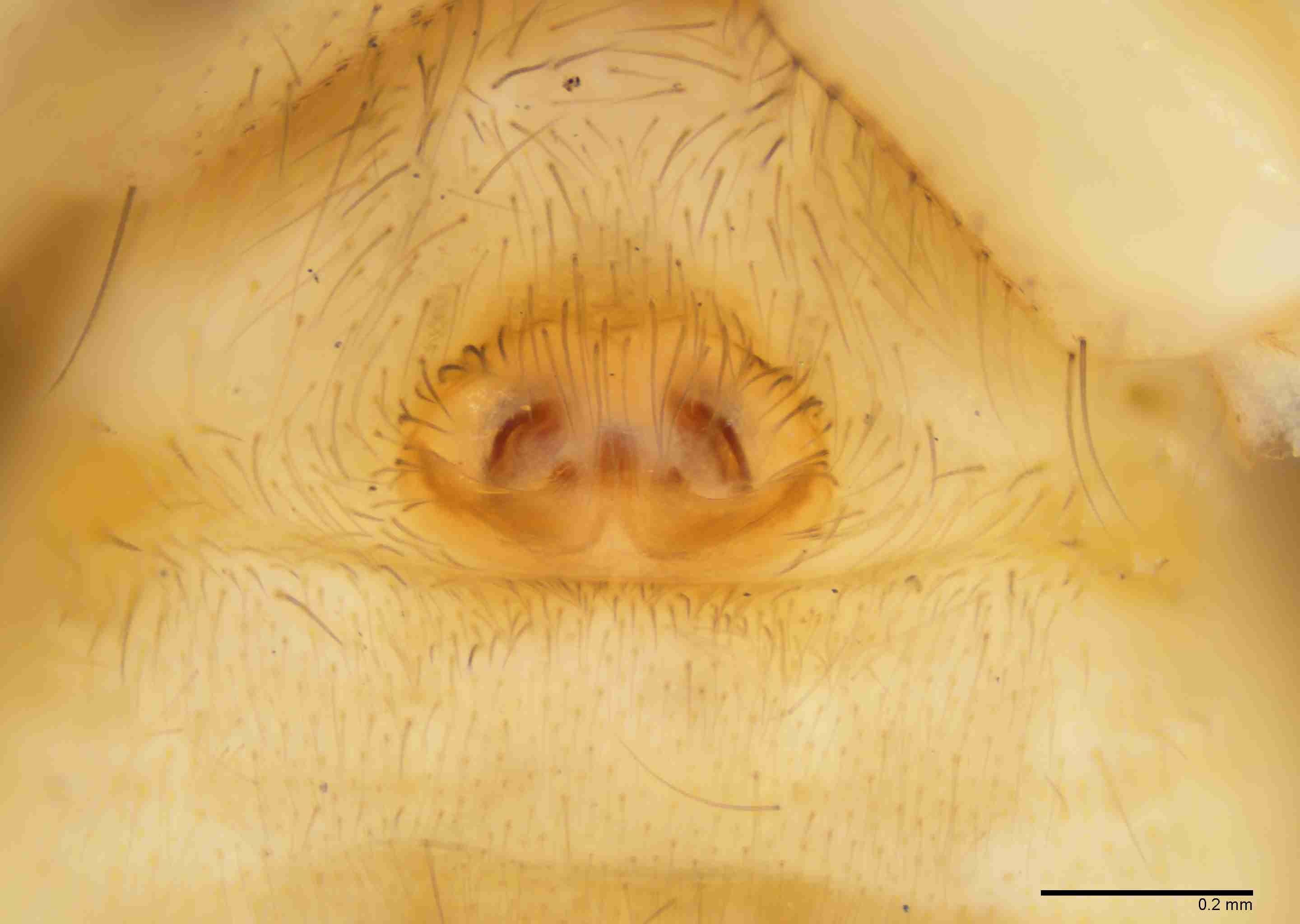 INVPICV025fpepivPXF237_100X_E2B.jpg