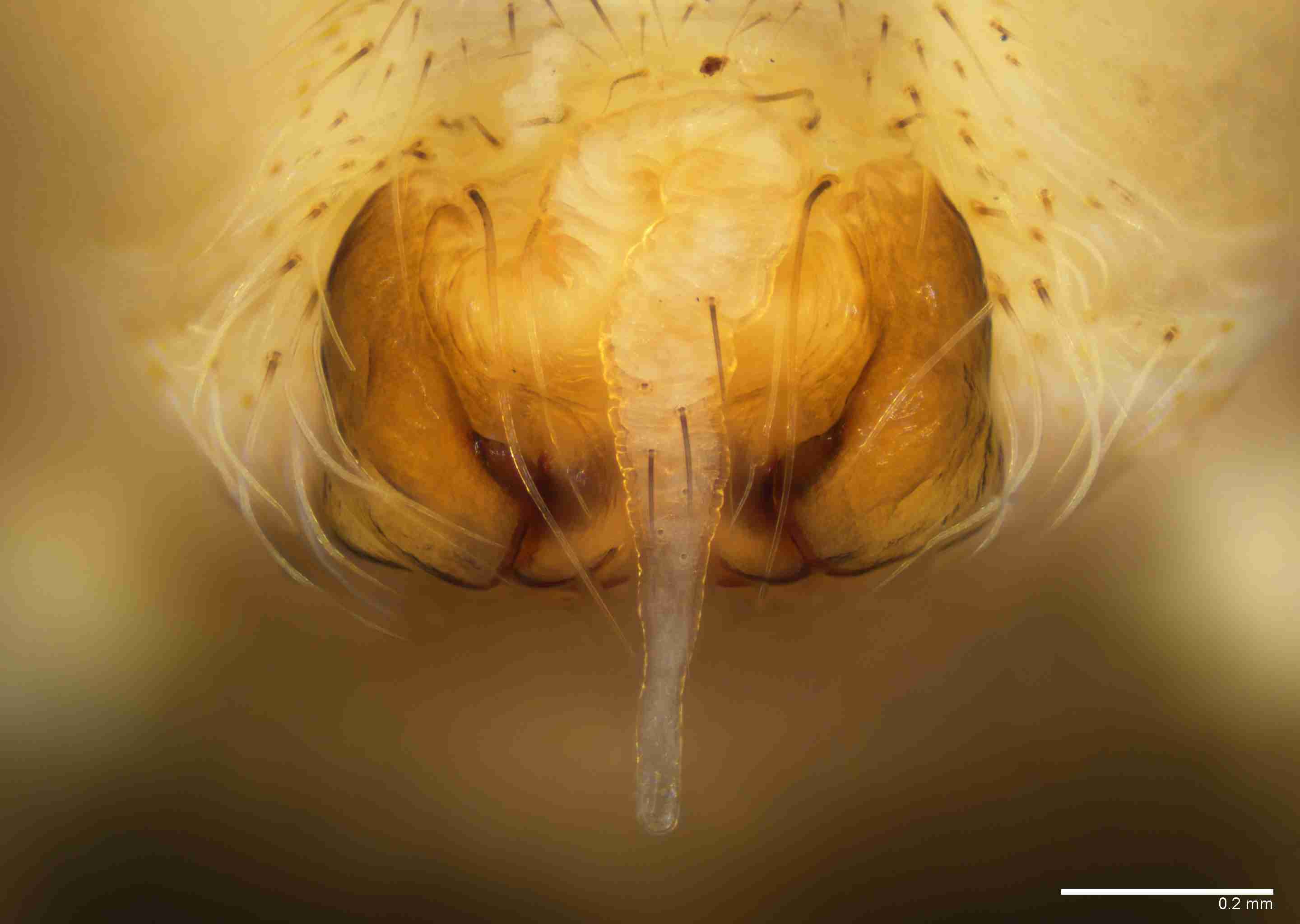 INVPICV030fpepivPIC418_100X_E2B.jpg