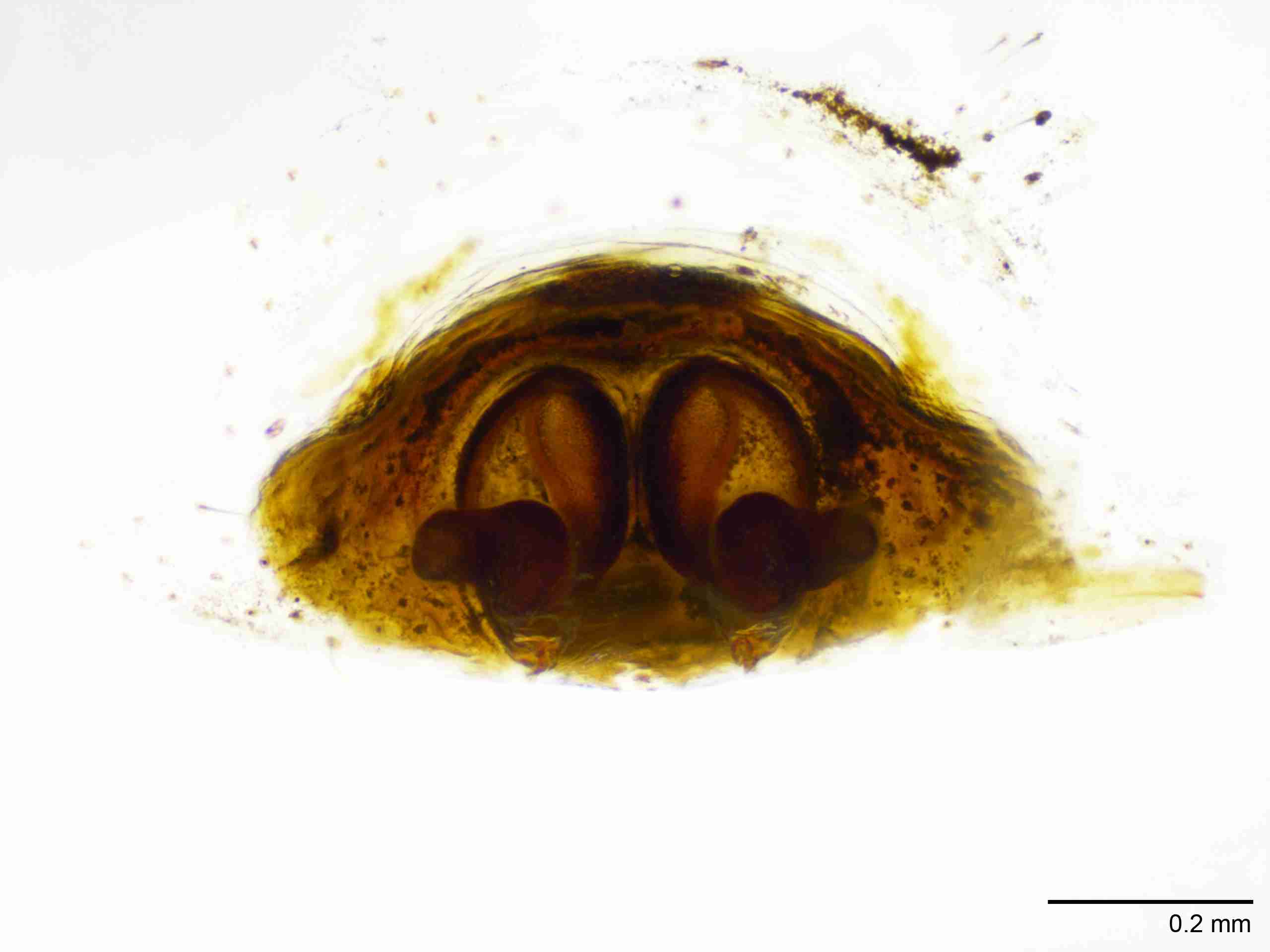 INVPICV103fcepidPIC543_100X_NL.jpg