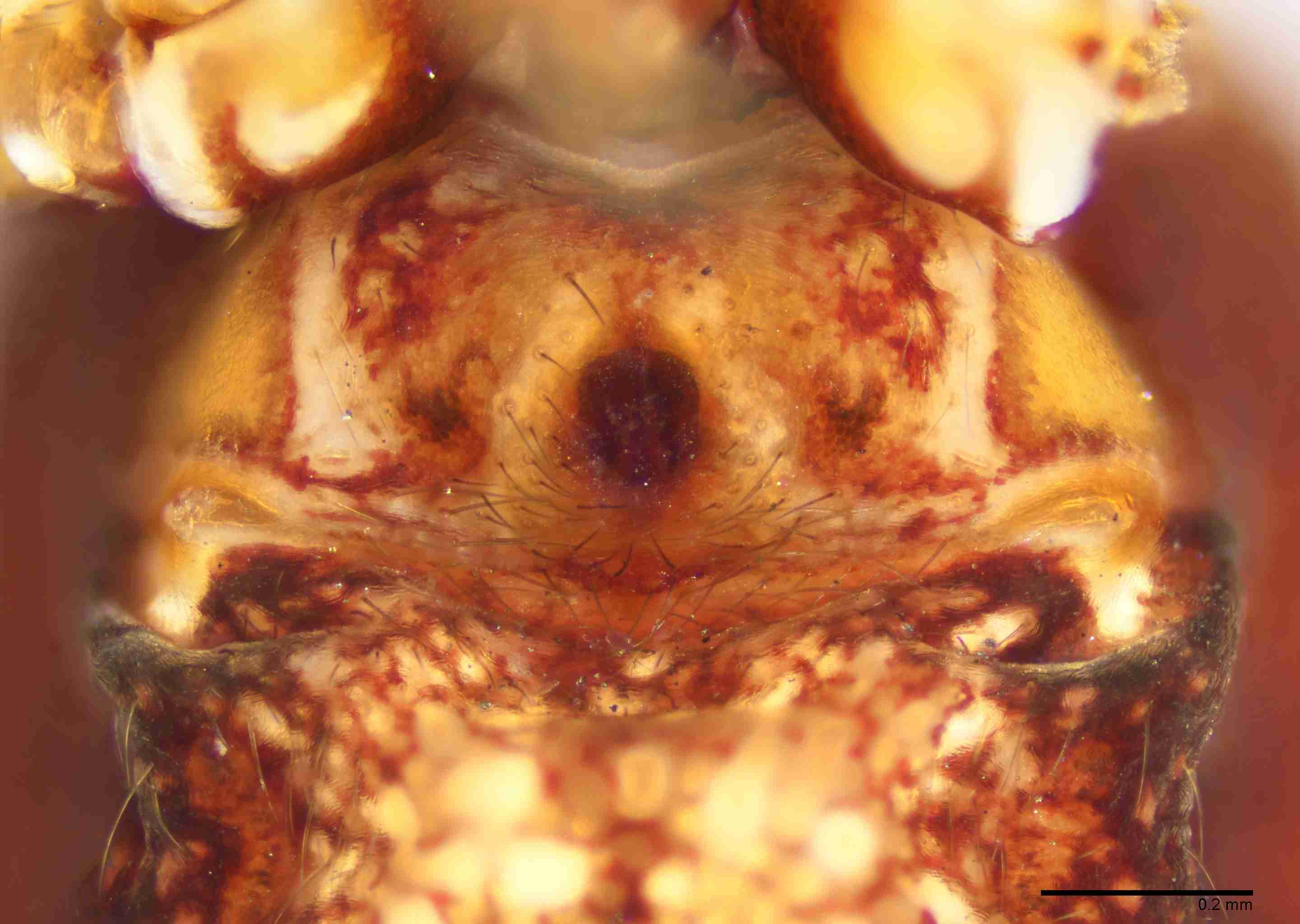 INVPICV239fpepivPXF146_100X_E2B.jpg
