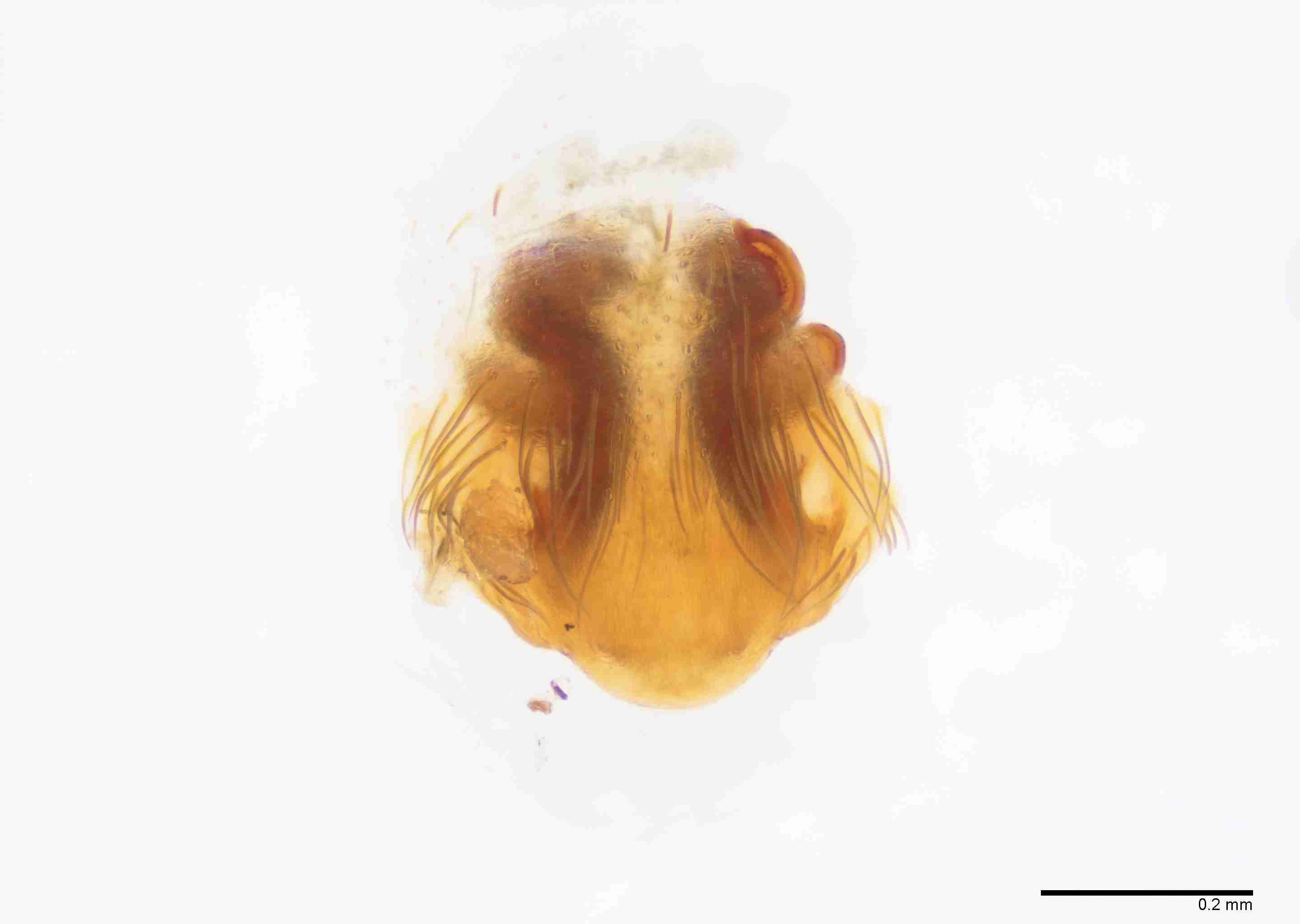 INVPICV285fpepivPXF044_100X_E2B.jpg