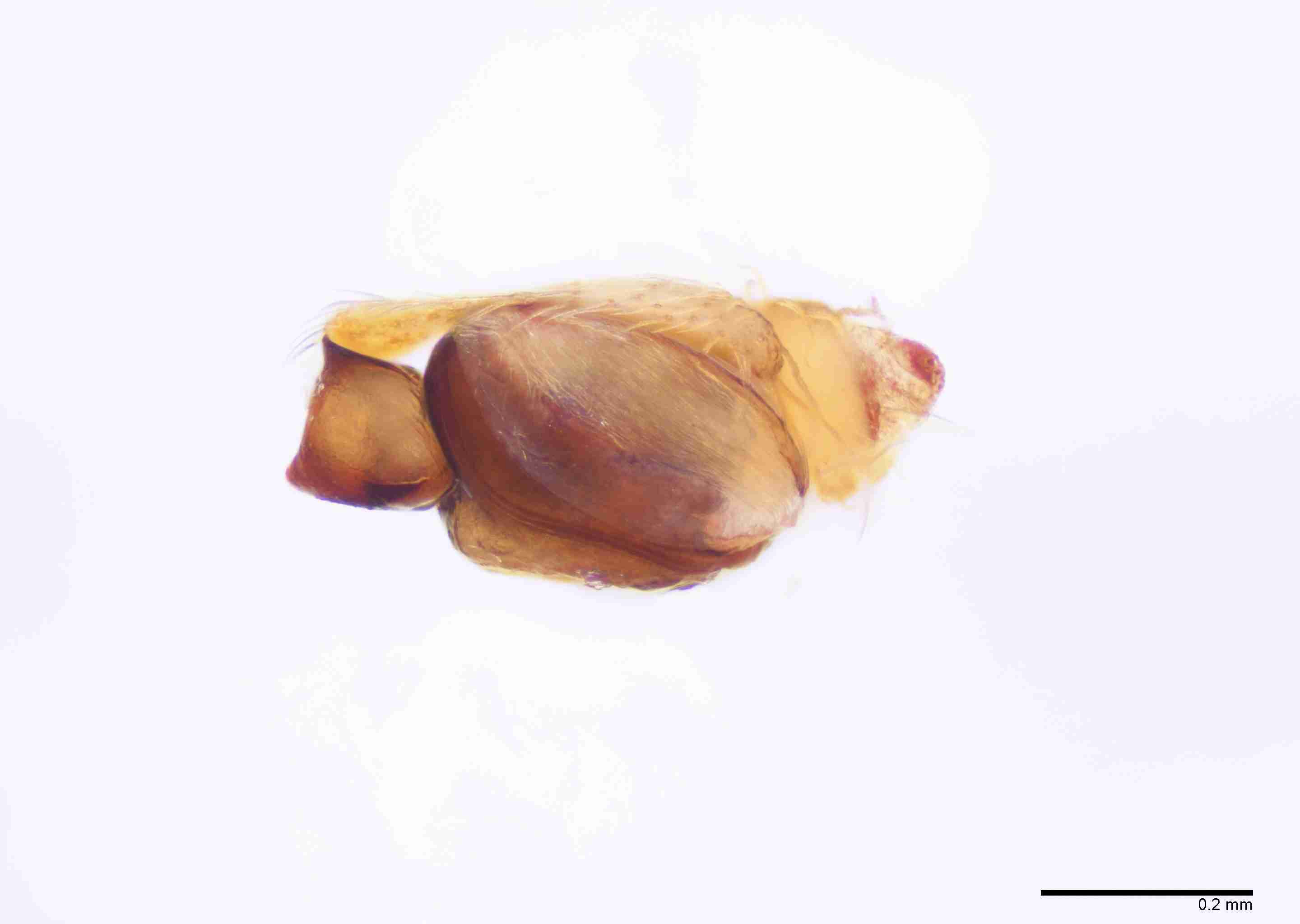 INVPICV285mppalpPXF043_100X_E2B.jpg