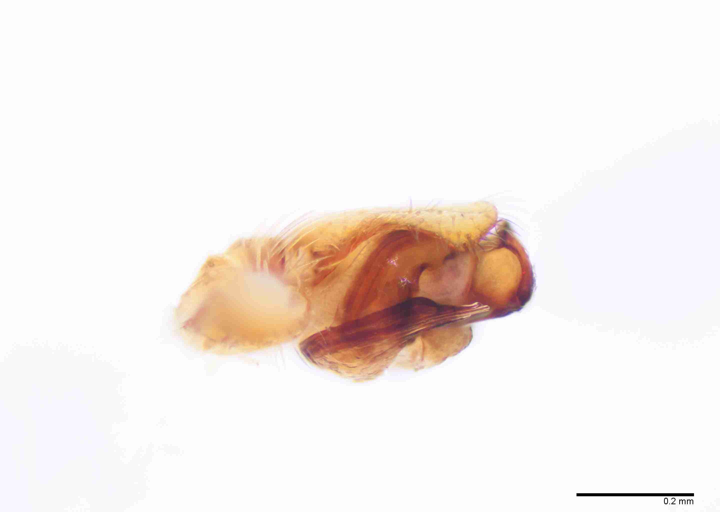 INVPICV285mppalrPXF043_100X_E2B.jpg