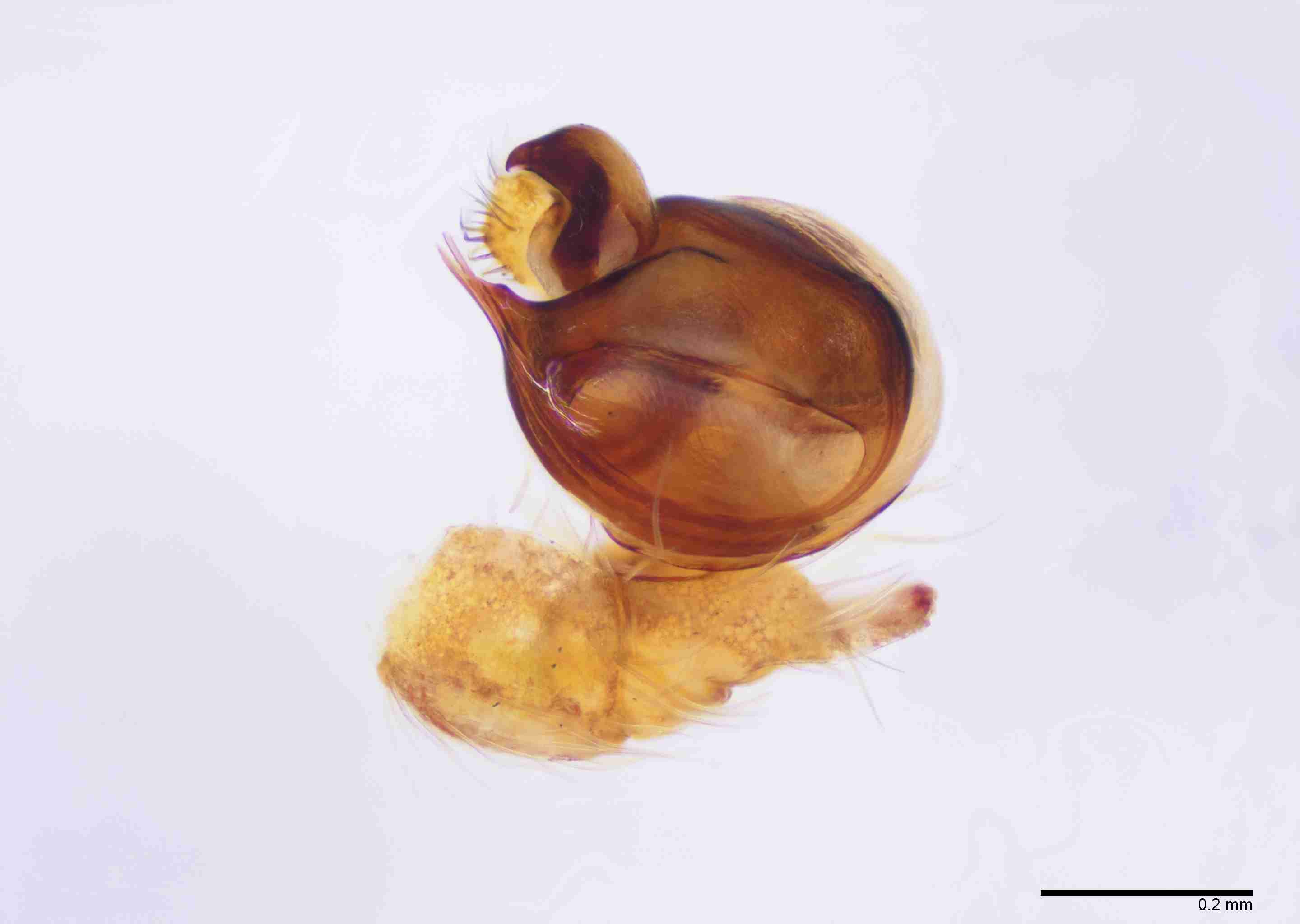 INVPICV285mppalvPXF043_100X_E2B.jpg
