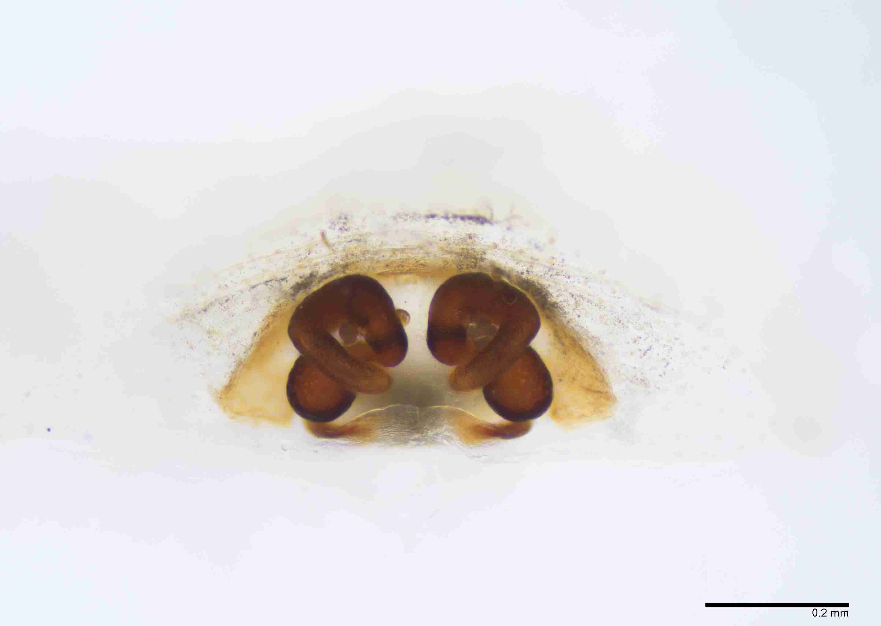 INVPICV286fpepidPXF032_100X_E2B.jpg