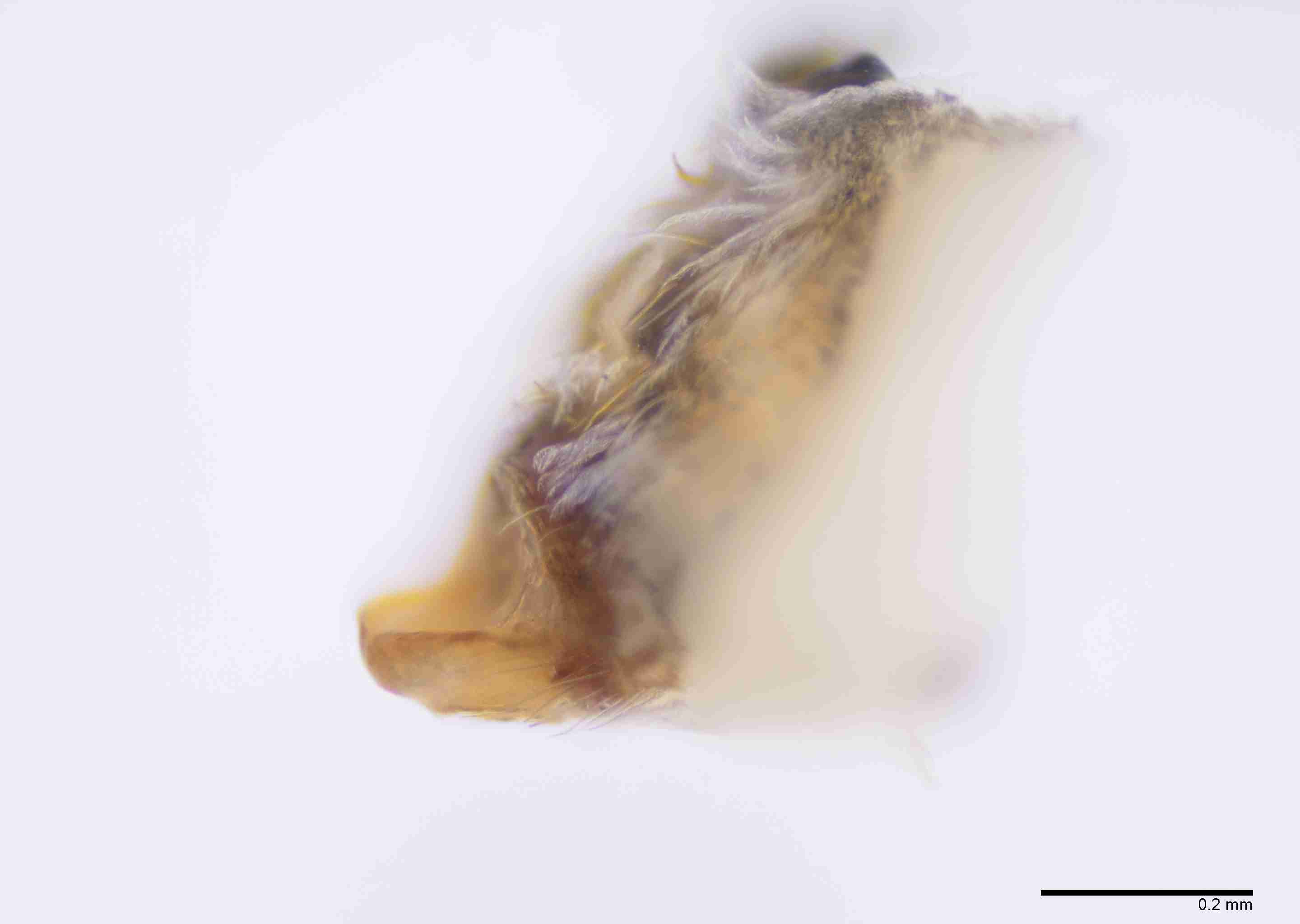 INVPICV286fpepilPXF032_100X_E2B.jpg