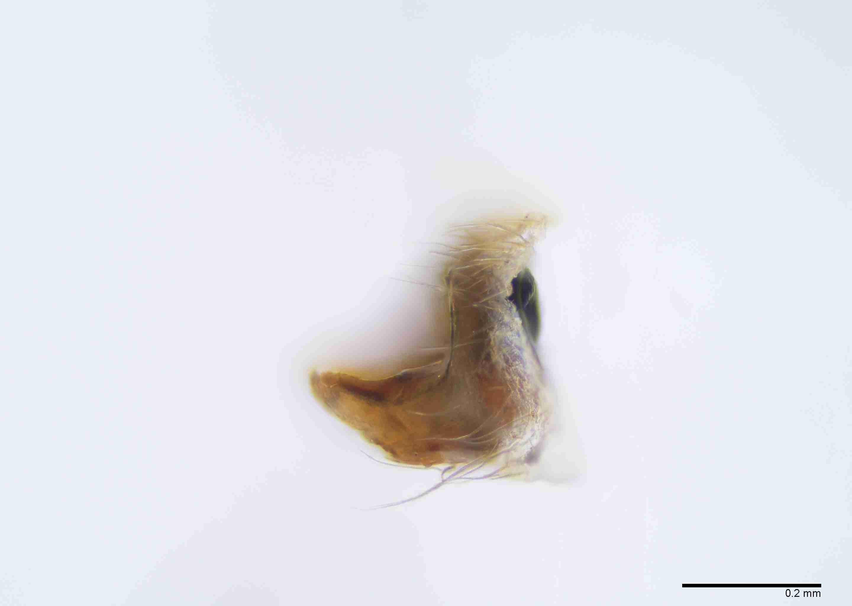 INVPICV287fpepilPXF034_100X_E2B.jpg