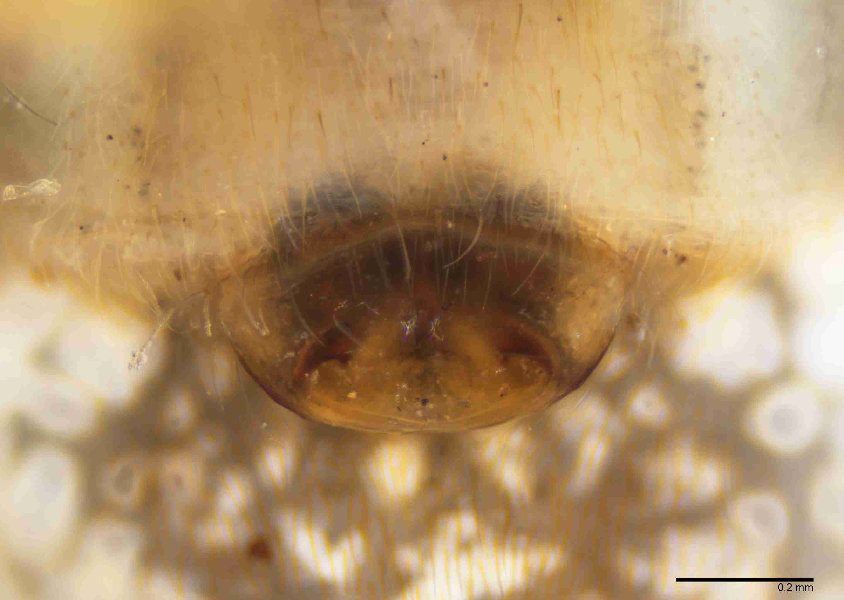 INVPICV287fpepivPXF034_100X_E2B.jpg