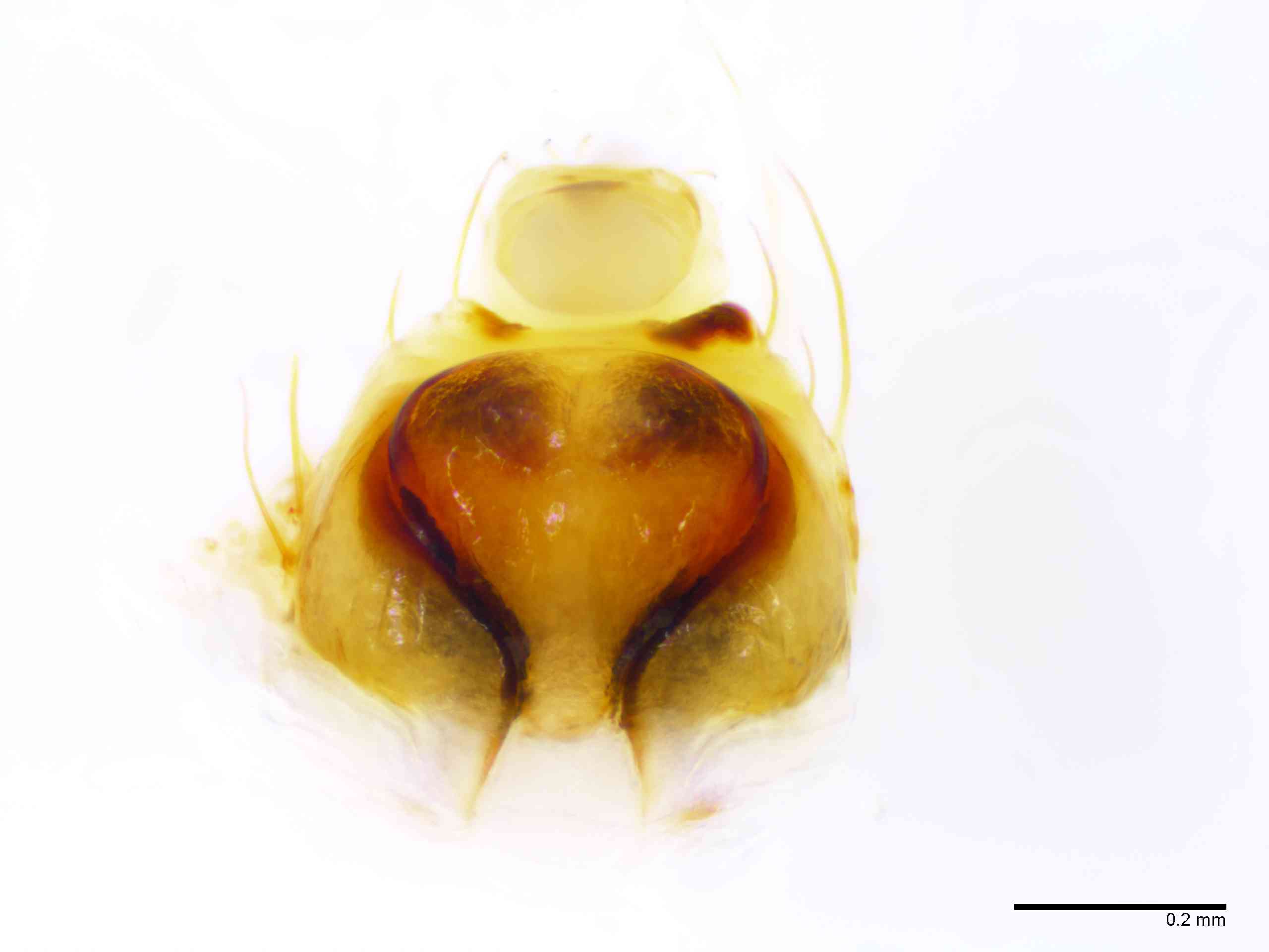 ARANEI0013fpepiTTXV339_100X_E2A.jpg