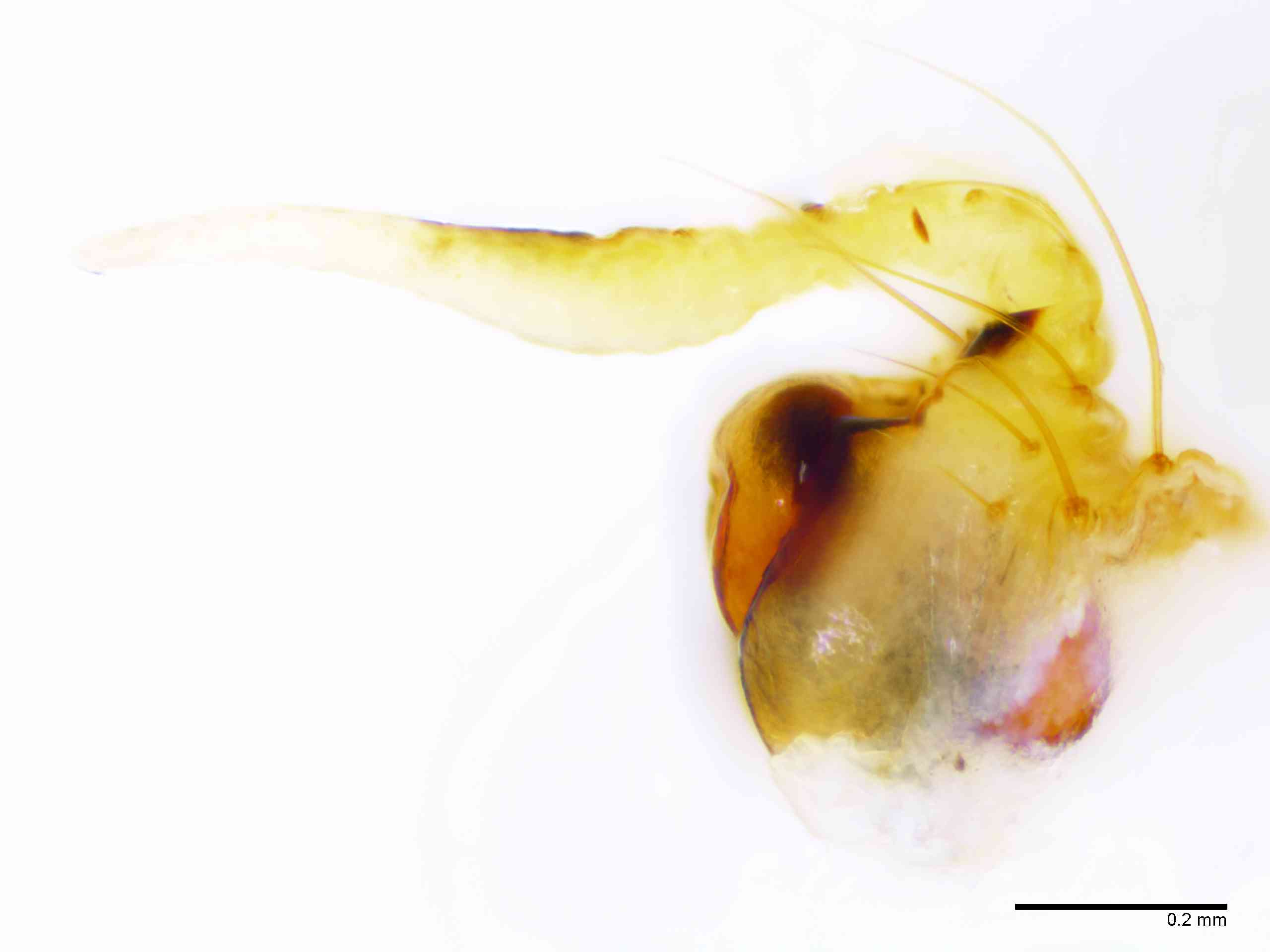 ARANEI0013fpepilTXV339_100X_E2A.jpg