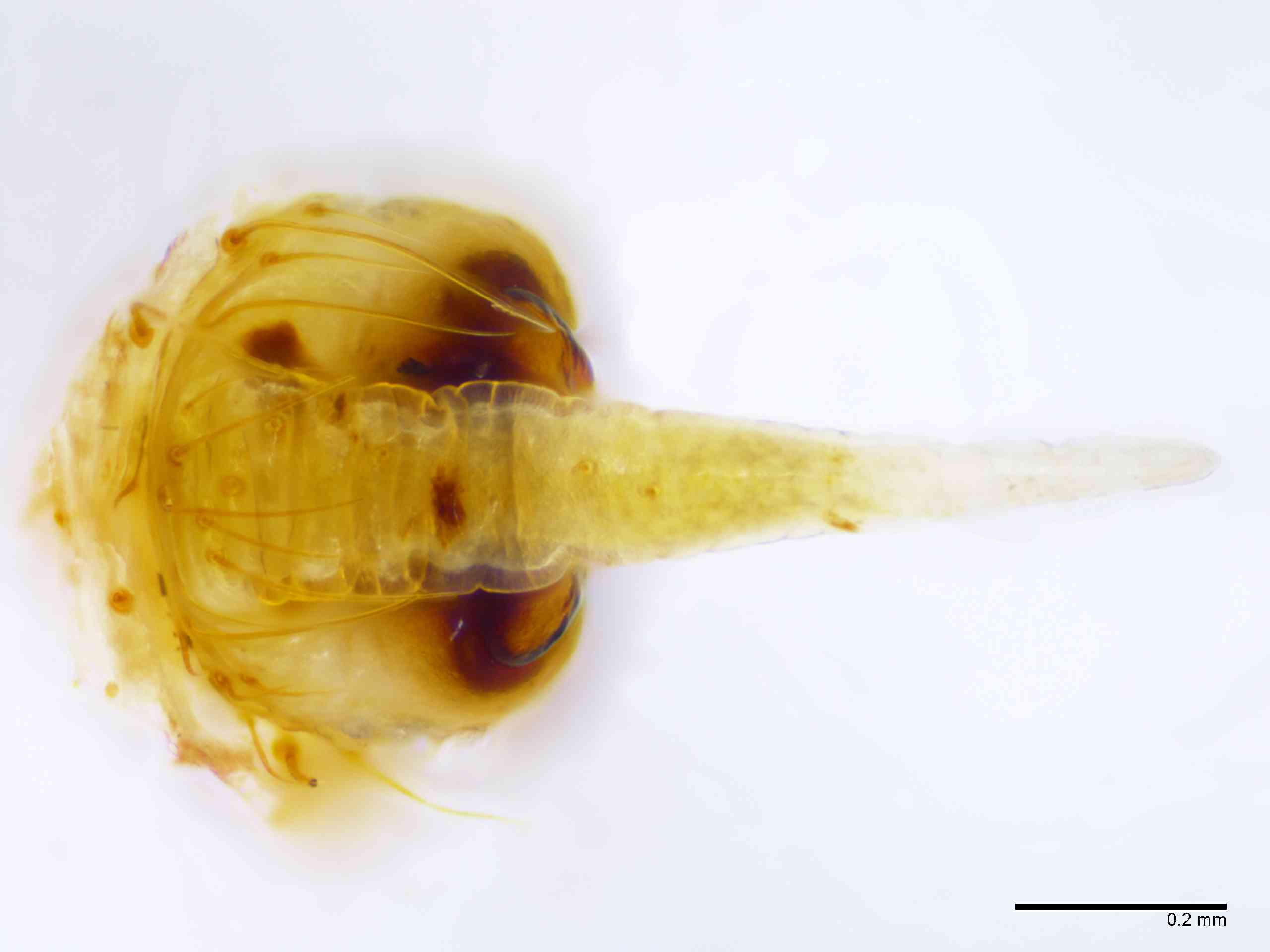 ARANEI0013fpepivTXV339_100X_E2A.jpg