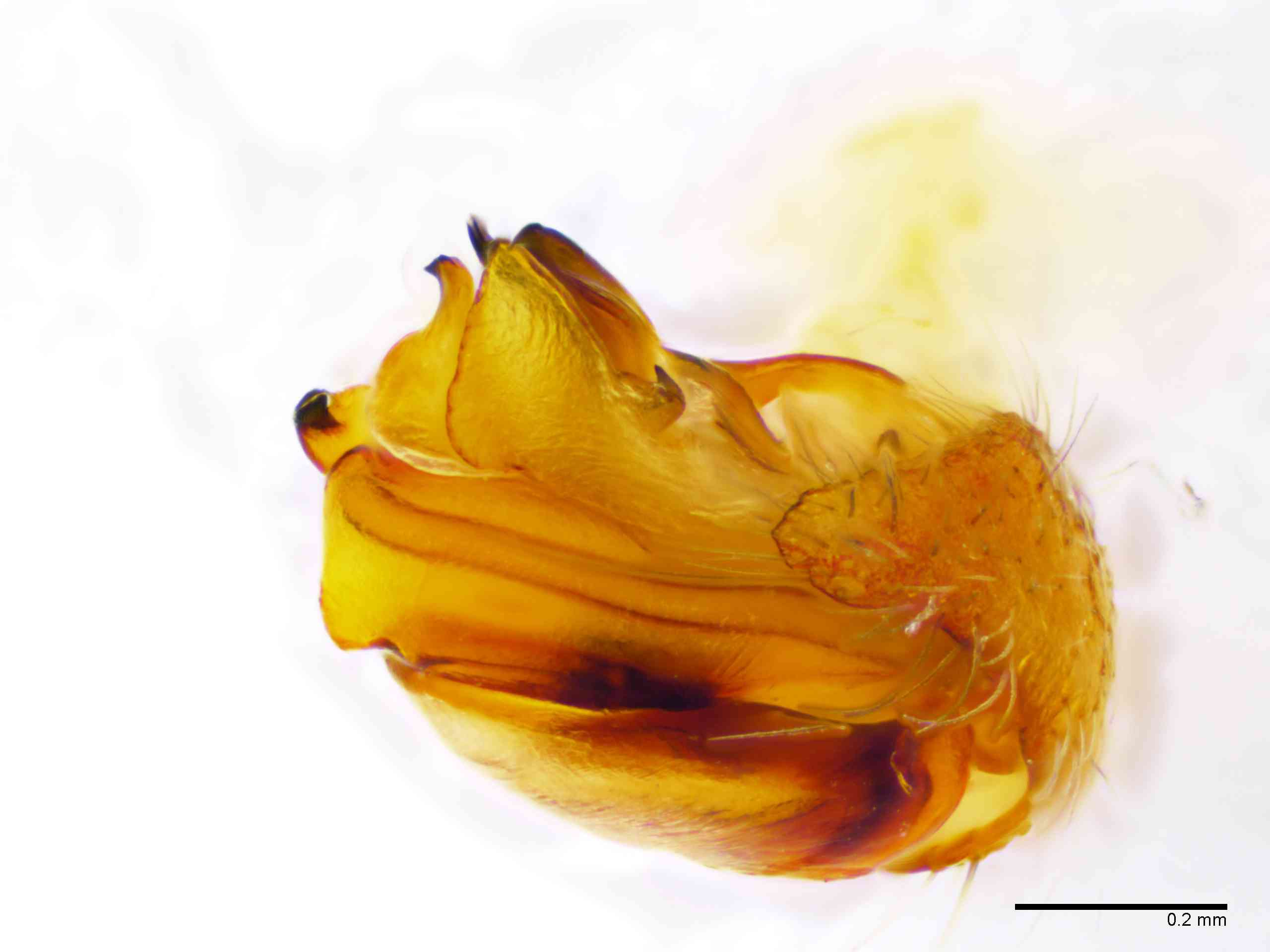 ARANEI0013mppalaTXV340_100X_E2A.jpg