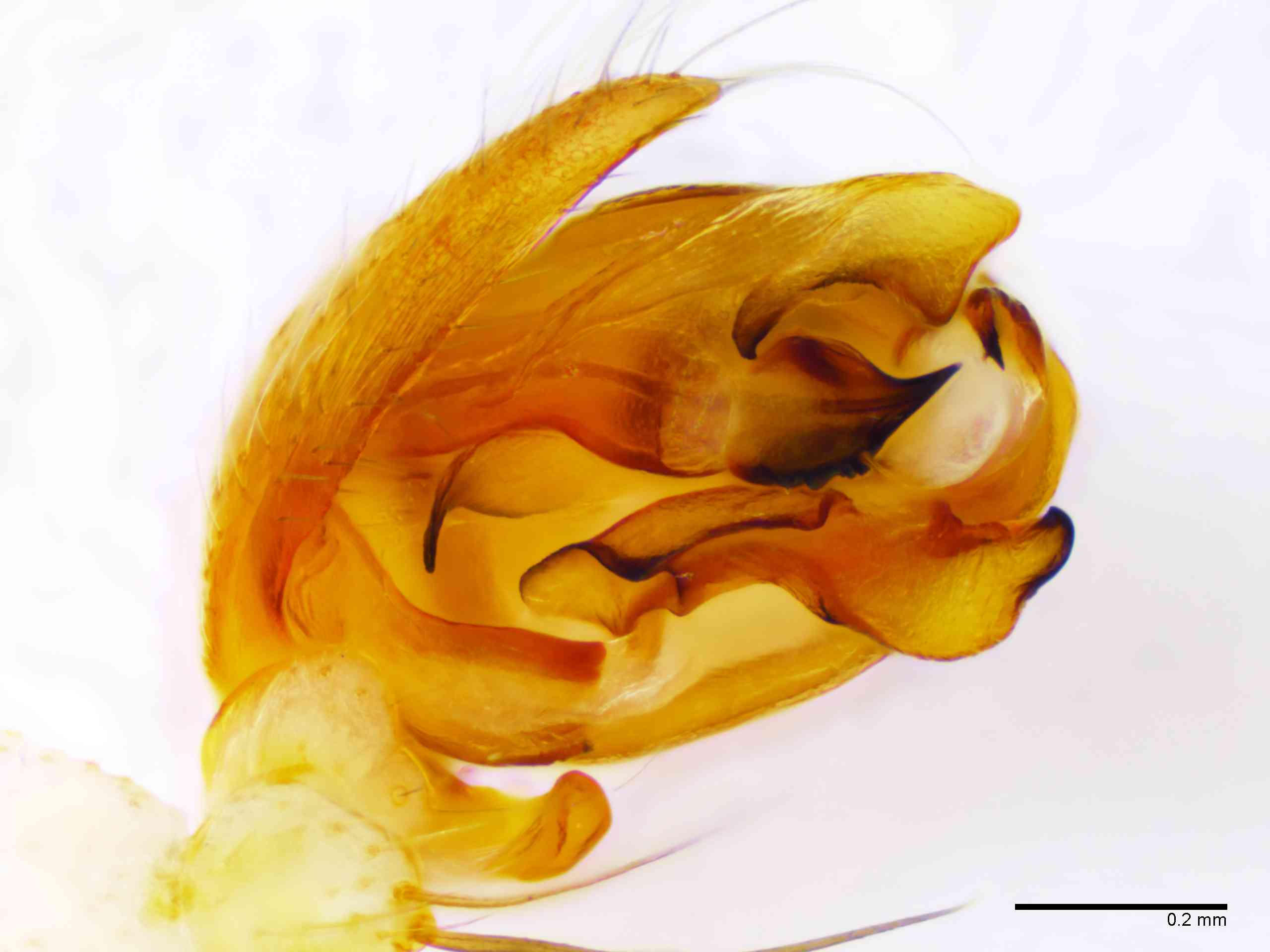 ARANEI0013mppalpTXV340_100X_E2A.jpg
