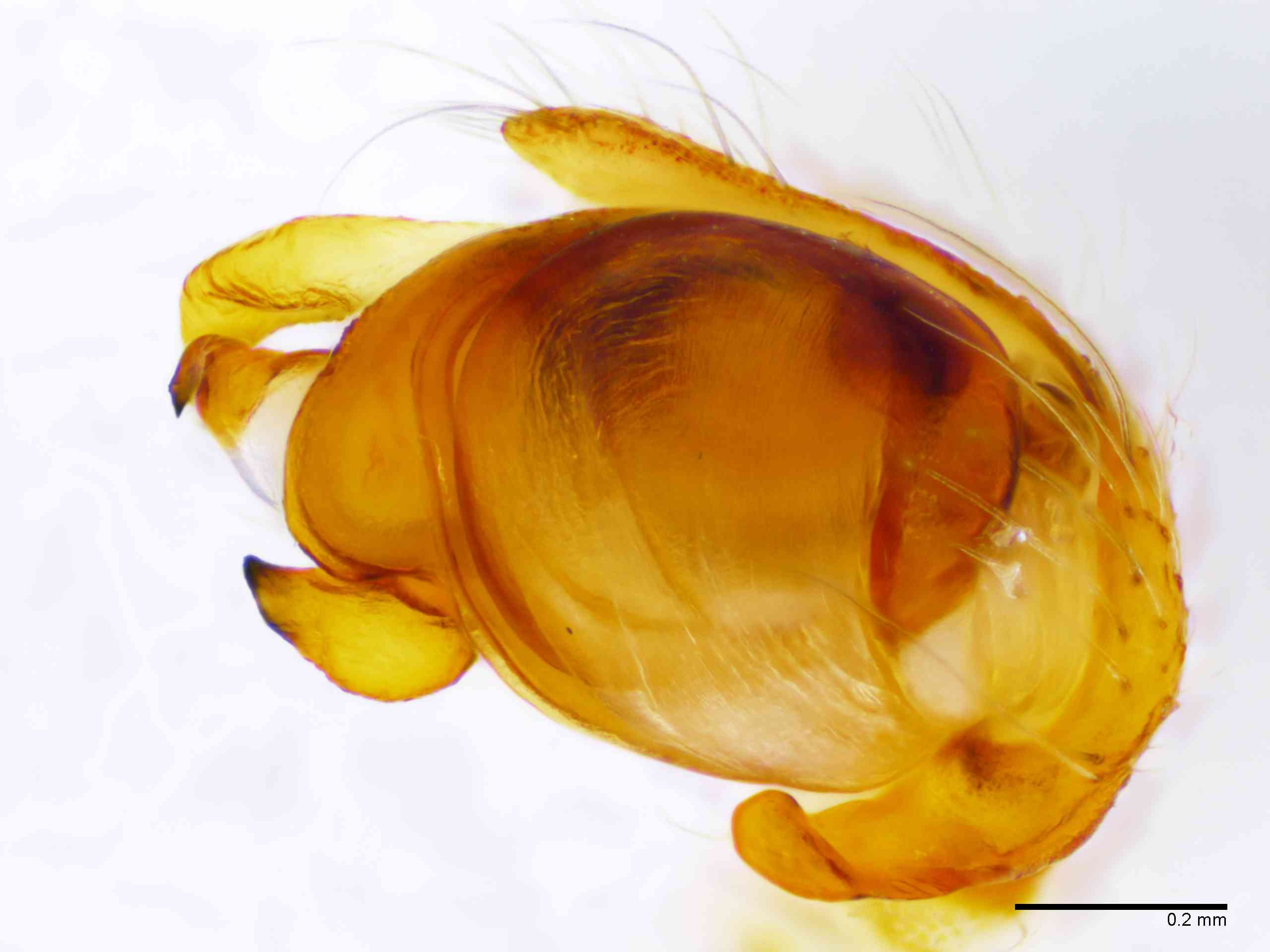 ARANEI0013mppalrTXV340_100X_E2A.jpg