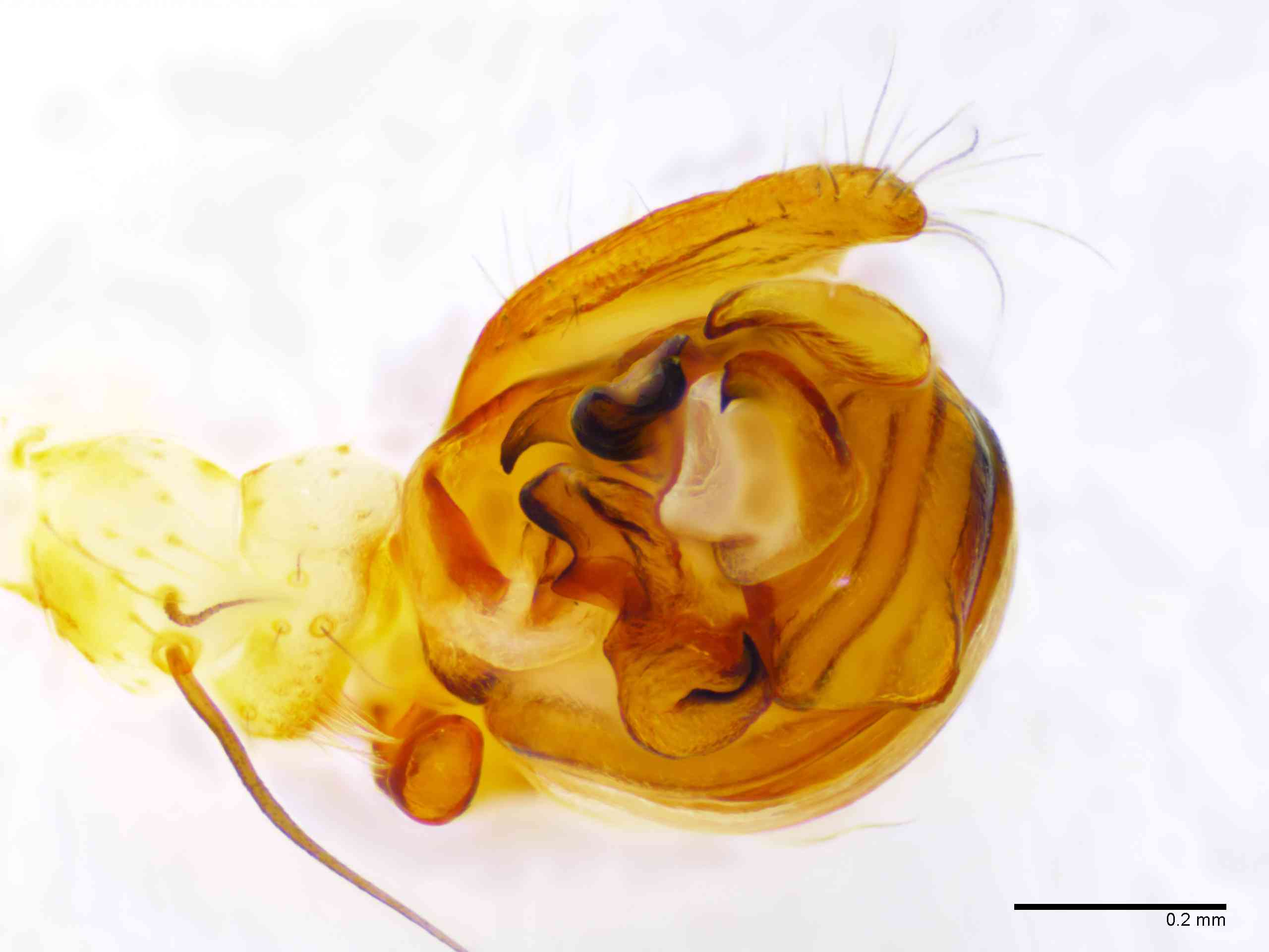 ARANEI0013mppalvTXV340_100X_E2A.jpg