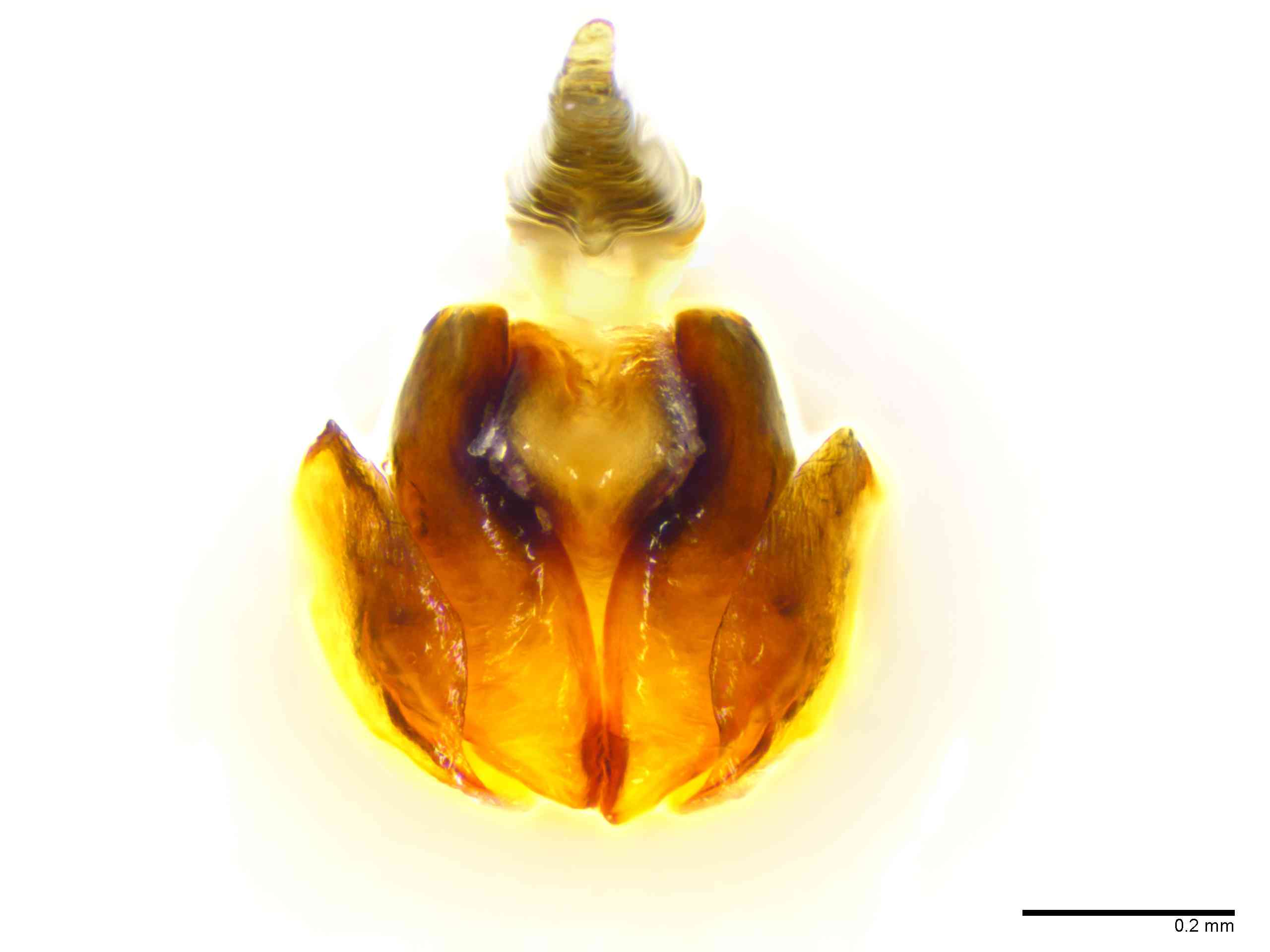 ARANEI0029fpepiTTXV346_100X_E2A.jpg