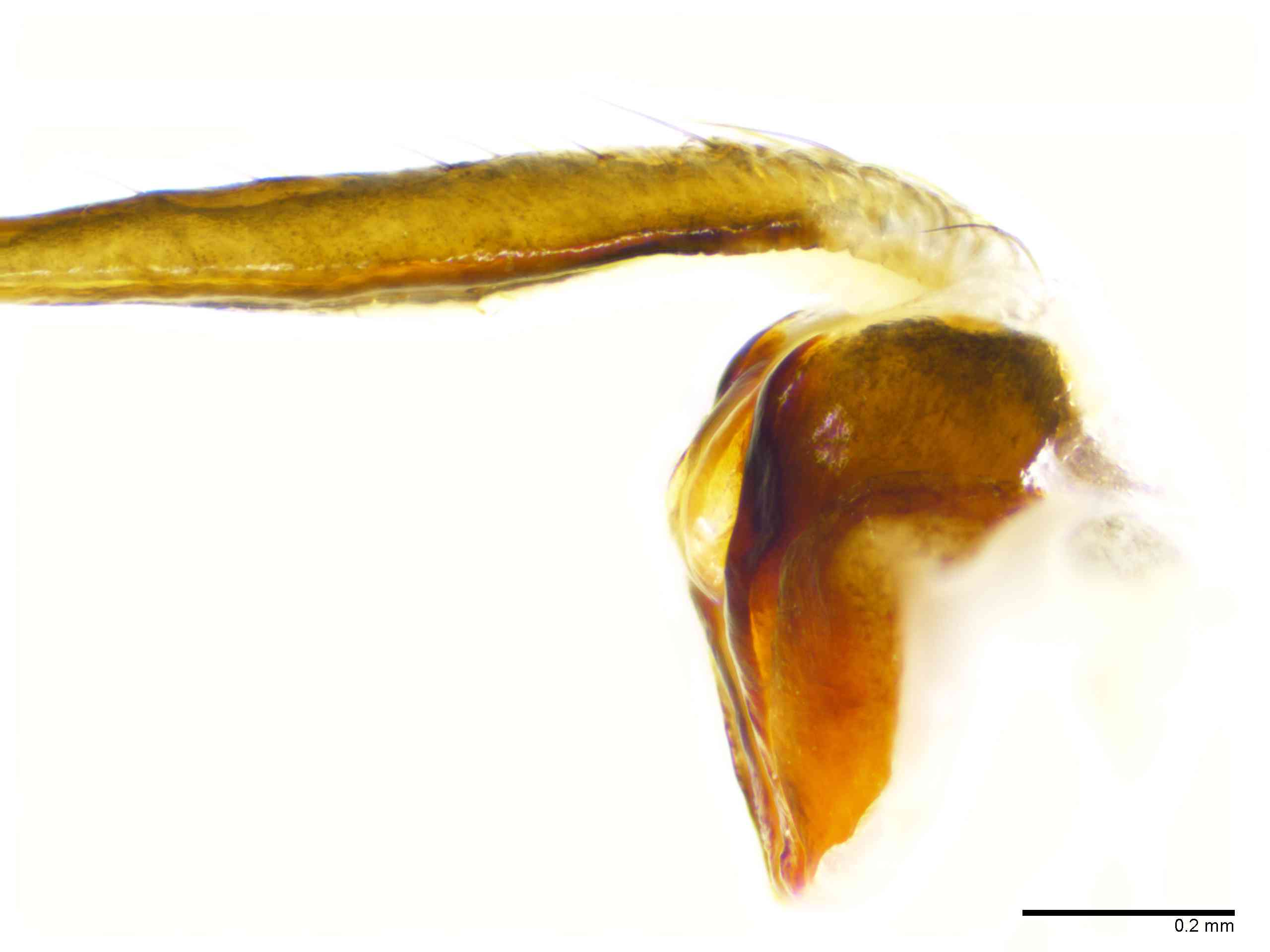 ARANEI0029fpepilTXV346_100X_E2A.jpg