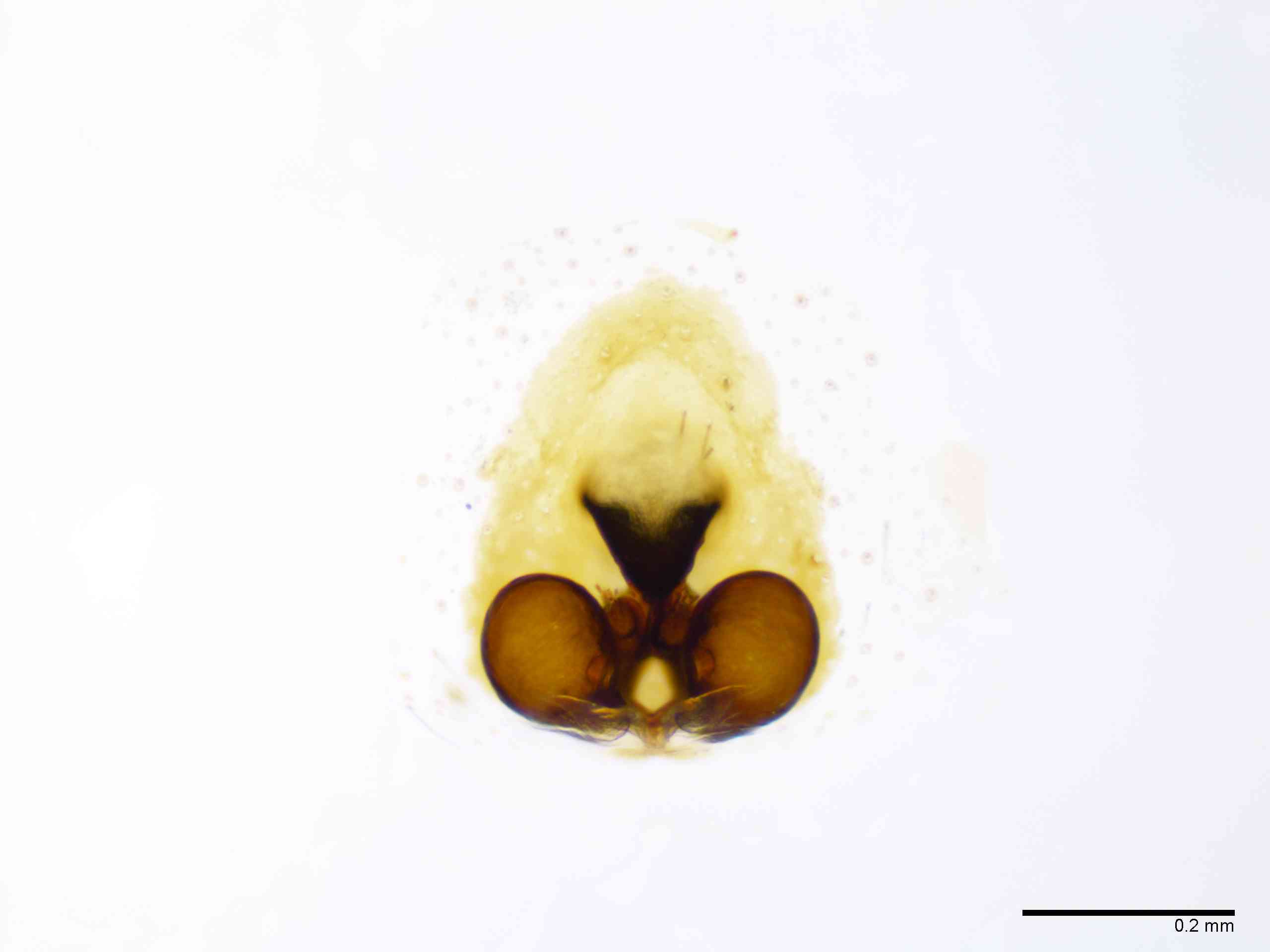 GNAPHO0052fcepidTXV067_100X_E2A.jpg