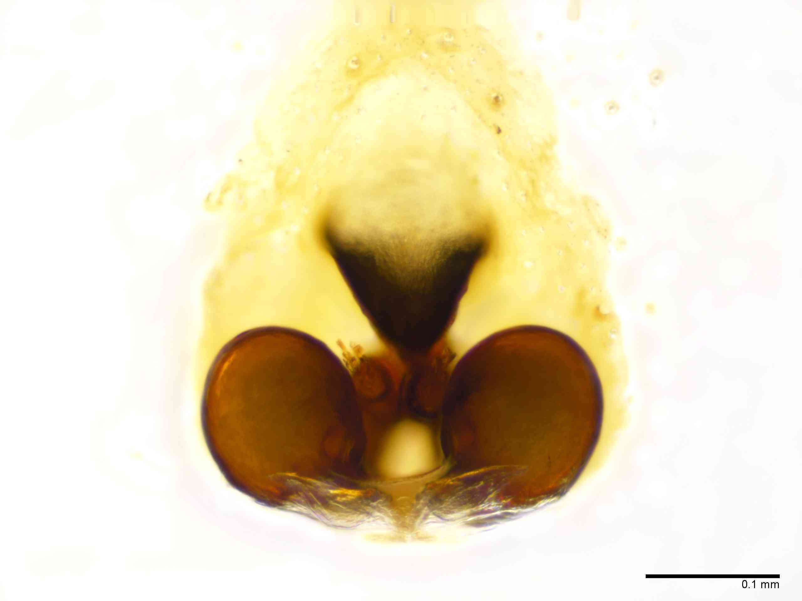 GNAPHO0052fcepidTXV067_200X_E2A.jpg