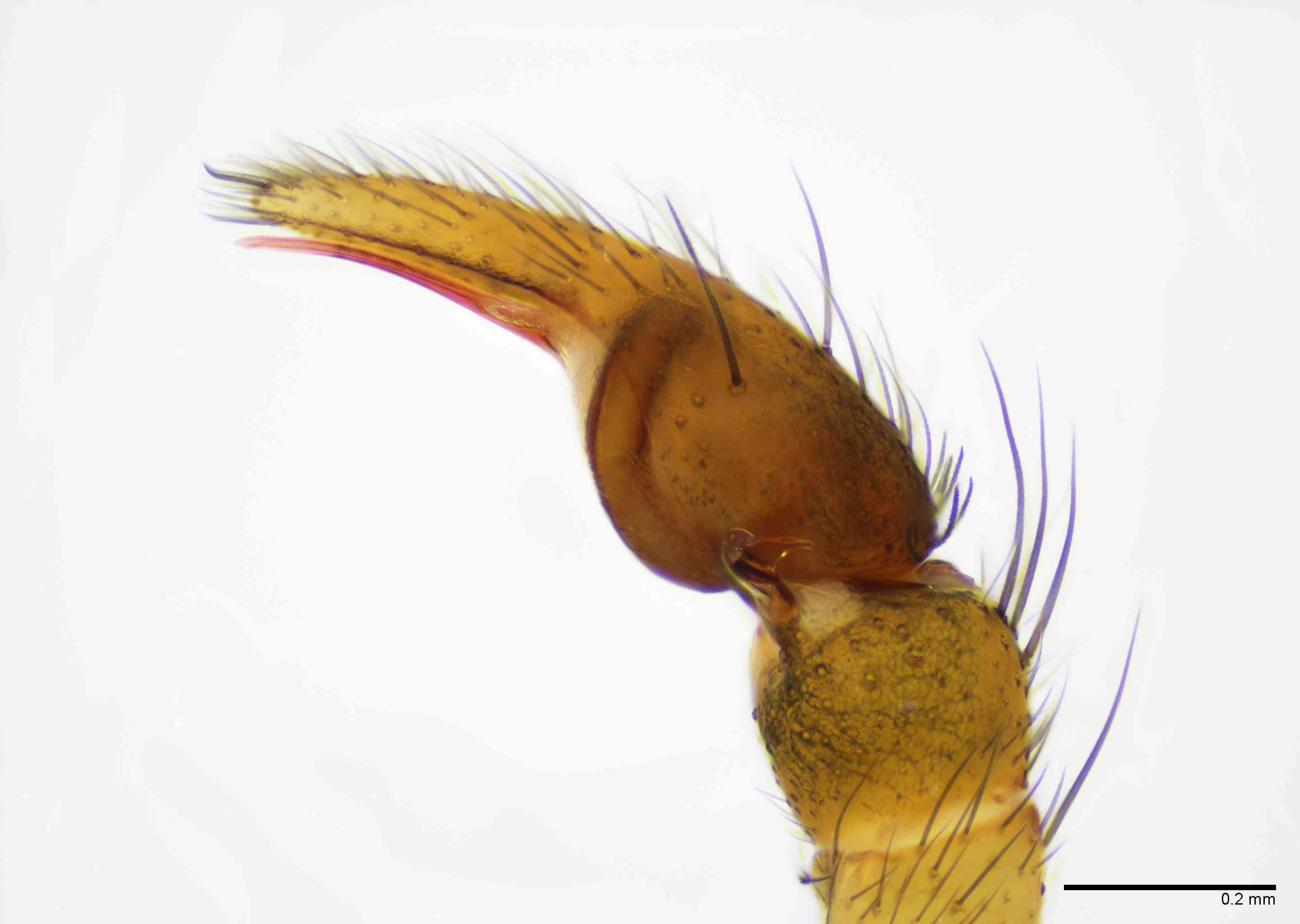 GNAPHO0052mppalrTXV066_100X_E2B.jpg