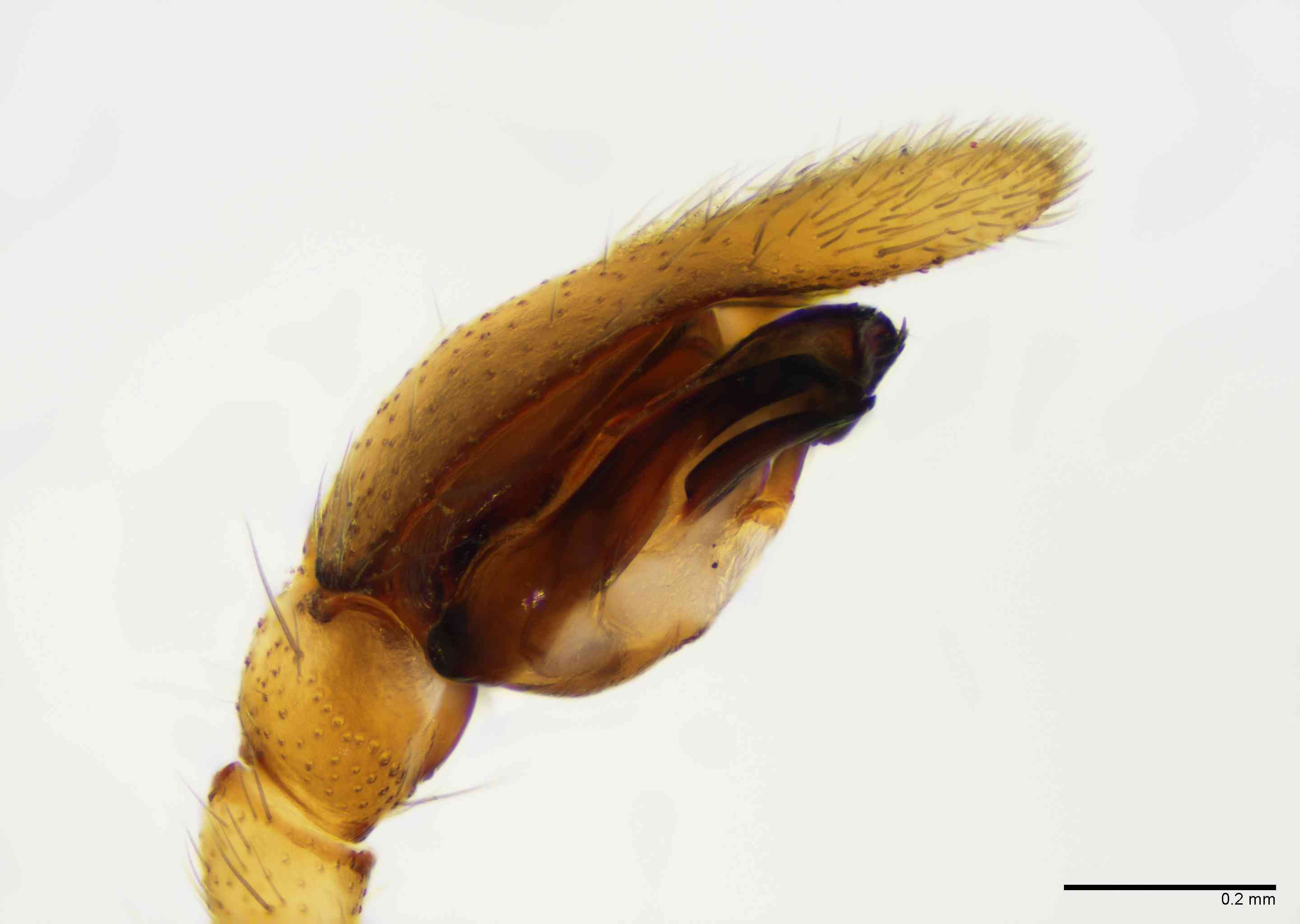GNAPHO0053mppalpTXV068_100X_E2B.jpg