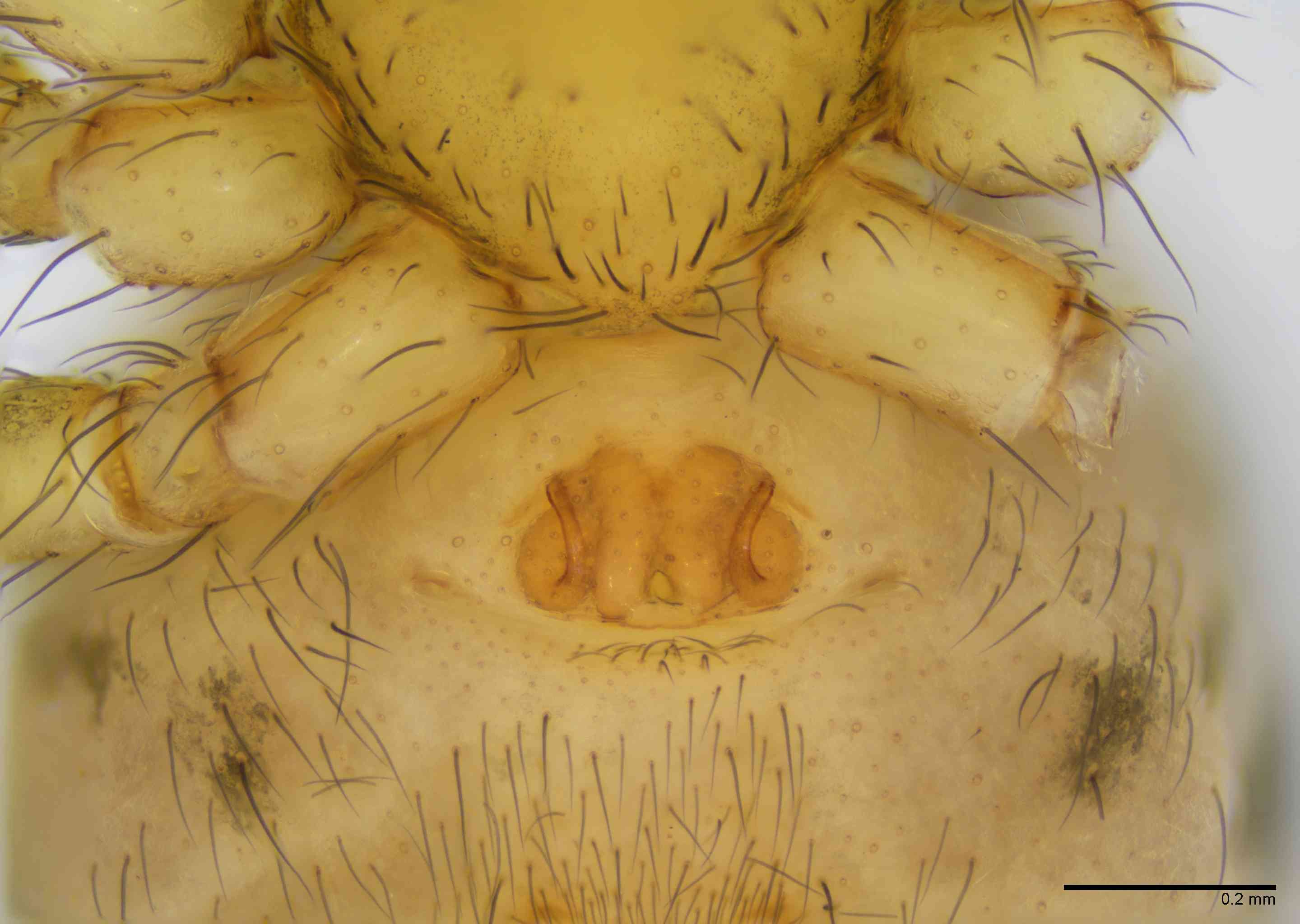 HAHNII0054fpepivTXV064_100X_E2B.jpg