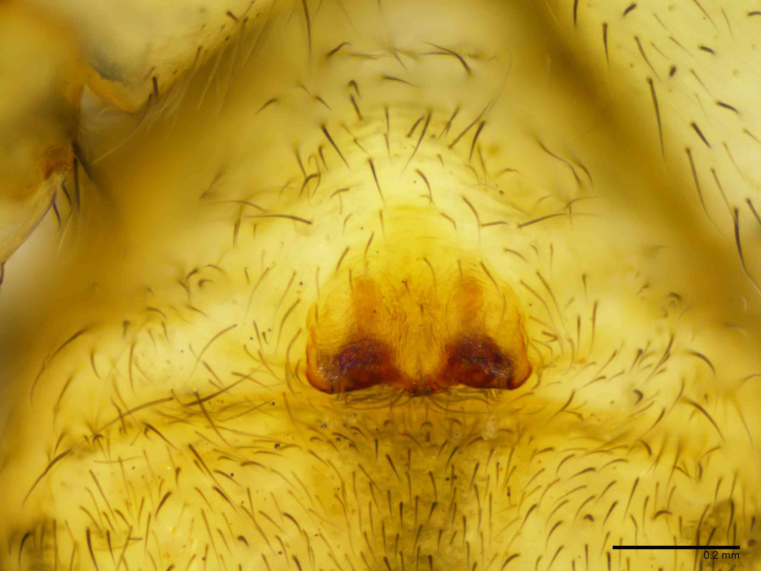 LYCOSI0071fpepivTXV329_100X_E2A.jpg