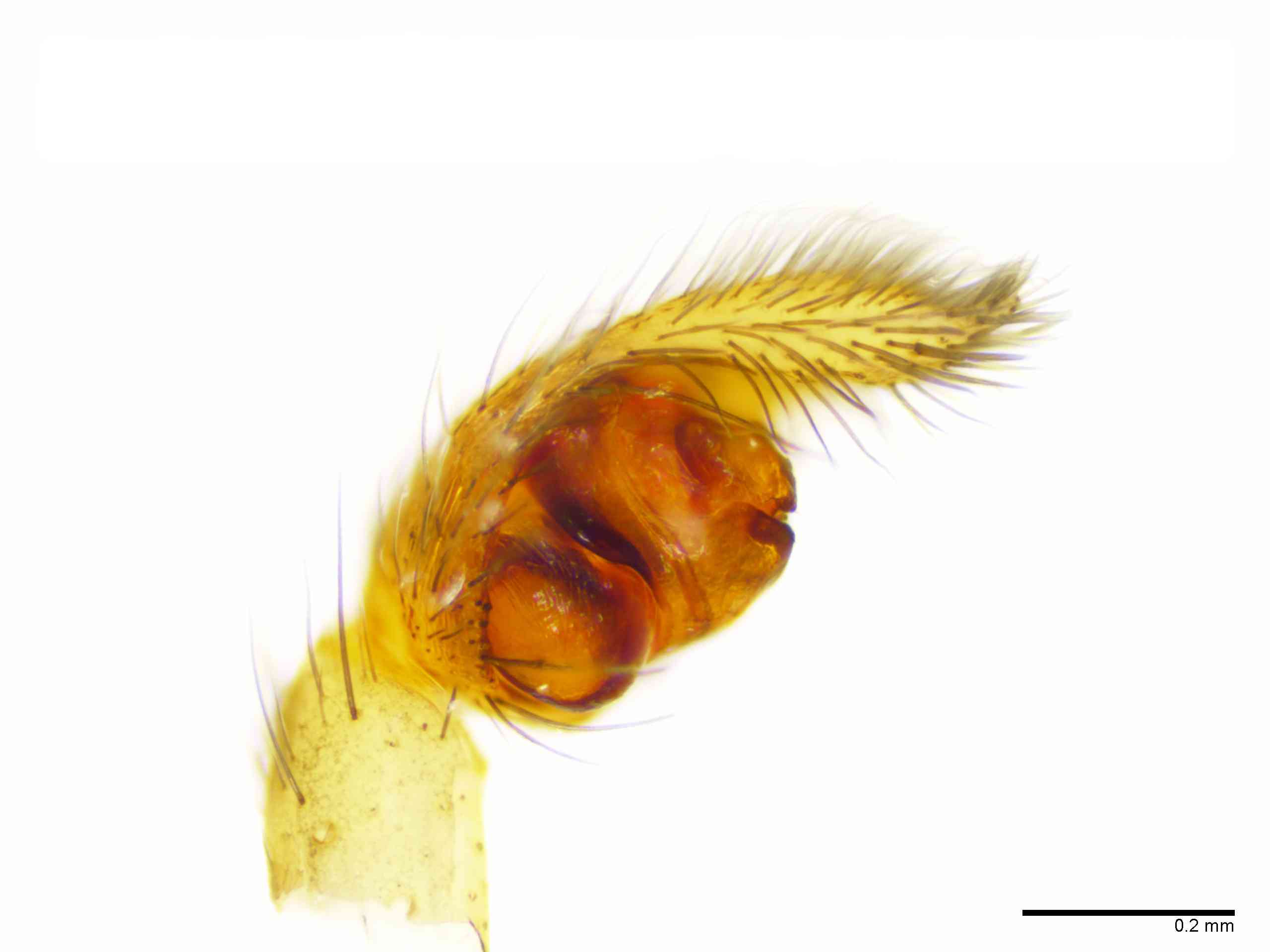 LYCOSI0071mppalpTXV329_100X_E2A.jpg