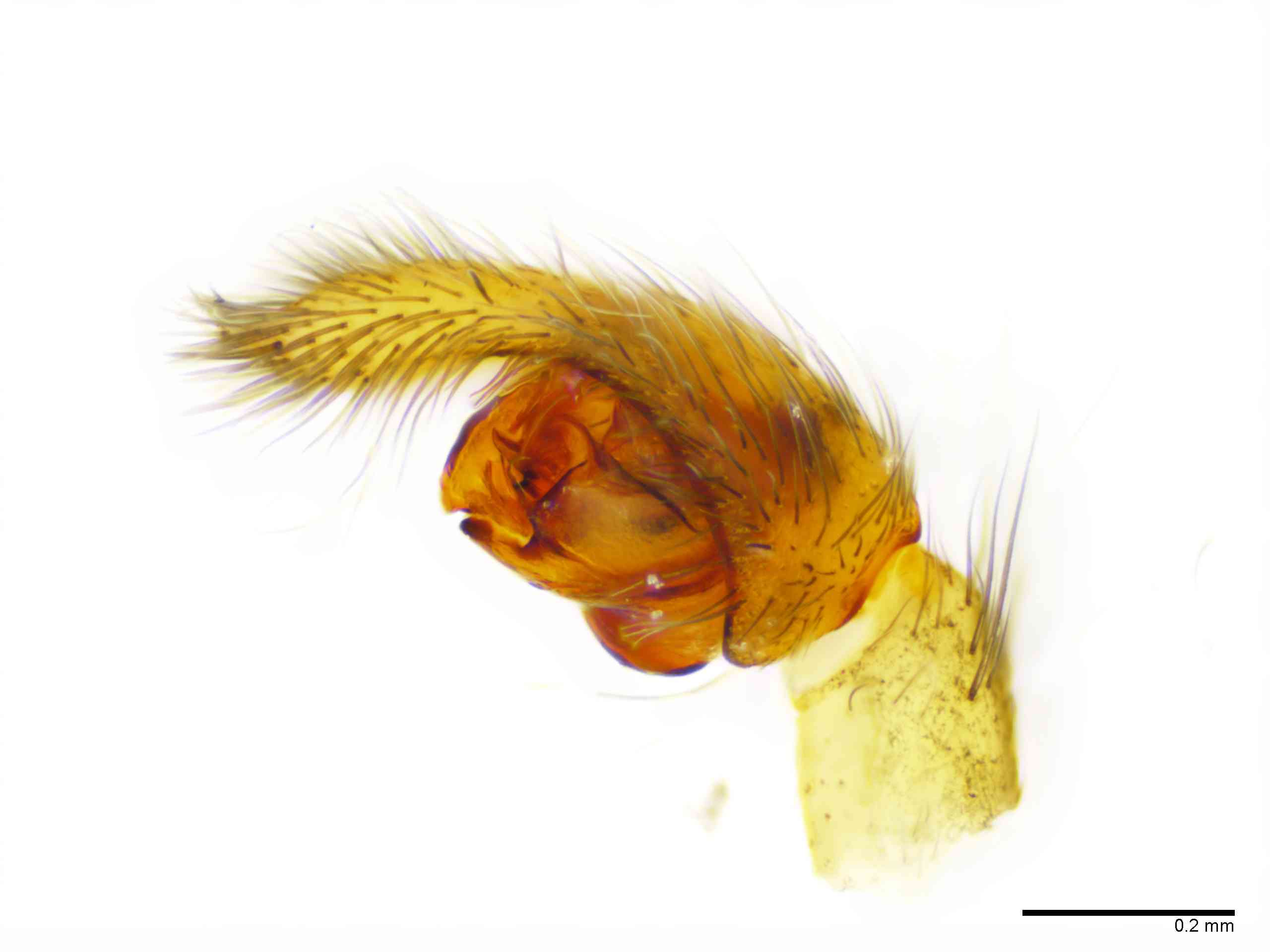 LYCOSI0071mppalrTXV329_100X_E2A.jpg