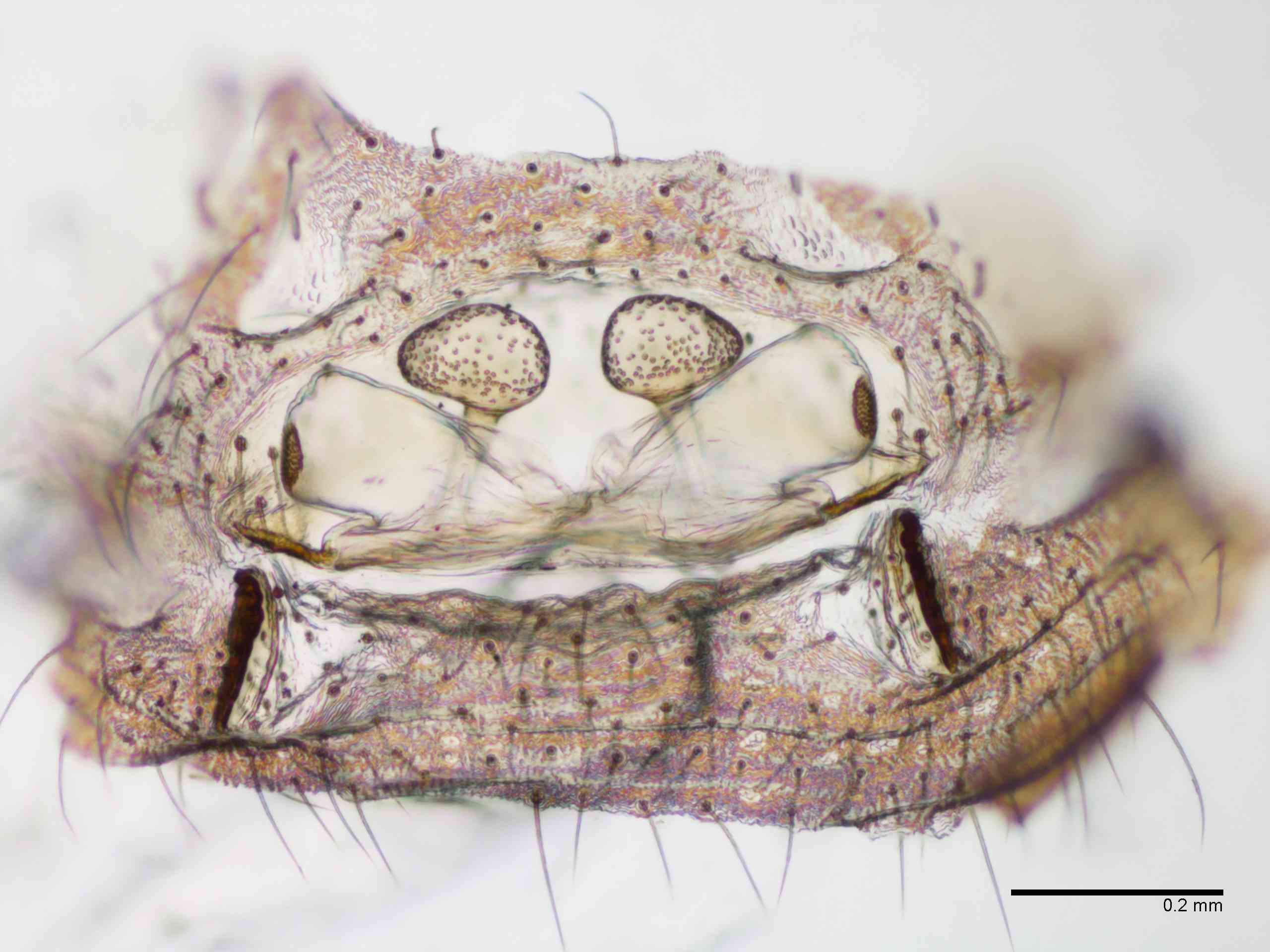 SCYTOD0138fcepidTXV603_100X_E2A.jpg