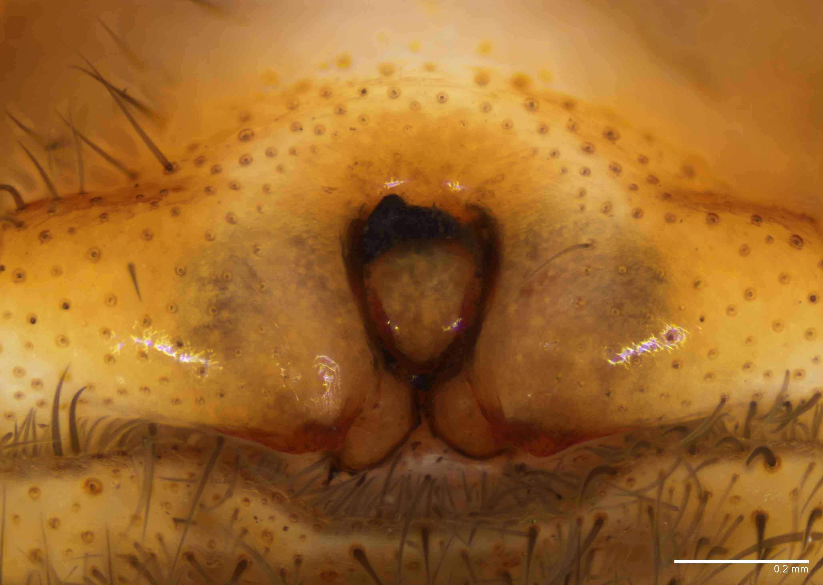 SPARAS0142fpepiTTXV060_100X_E2B.jpg