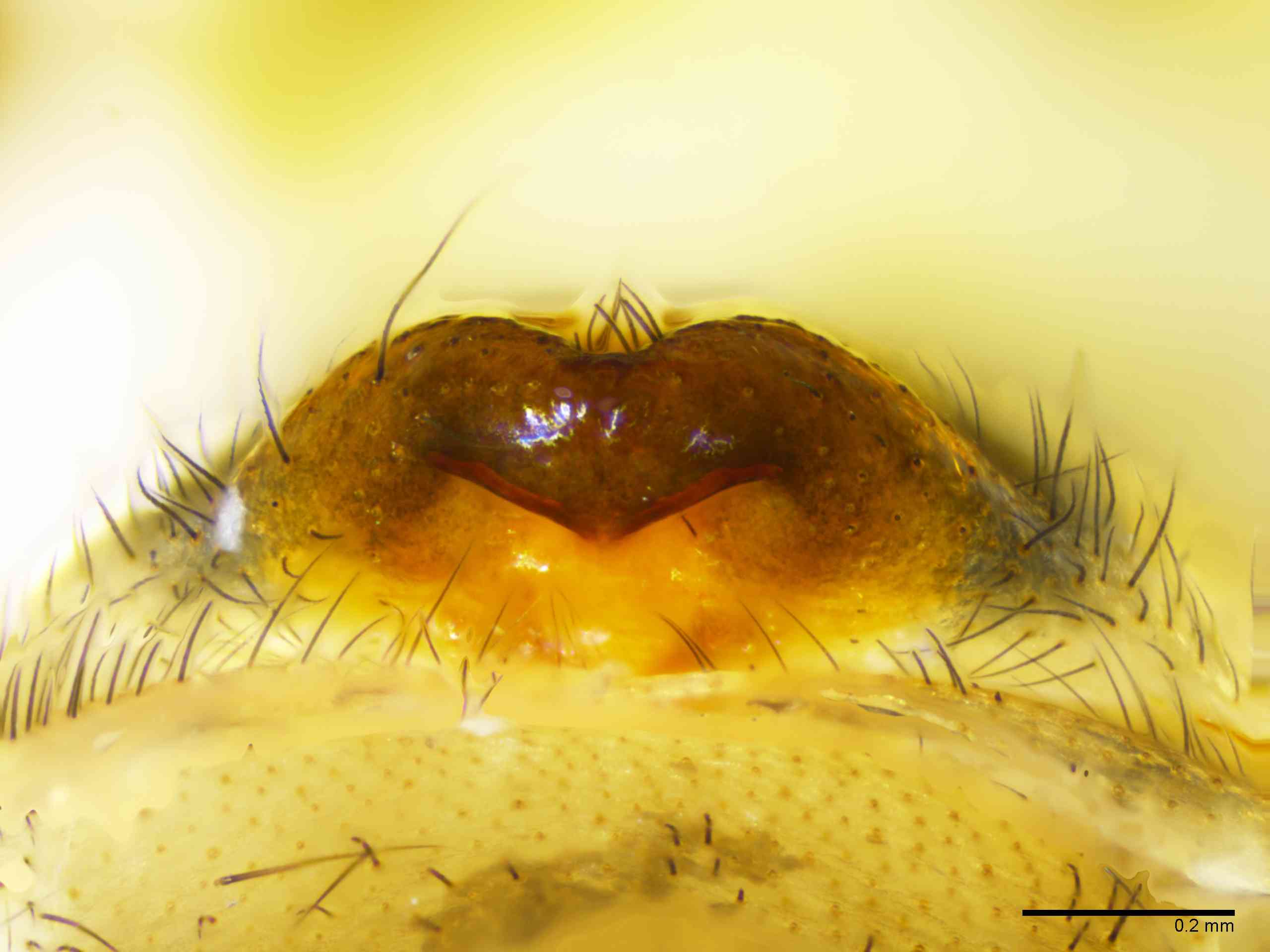 TETRAG0145fpepiTTXV309_100X_E2A.jpg