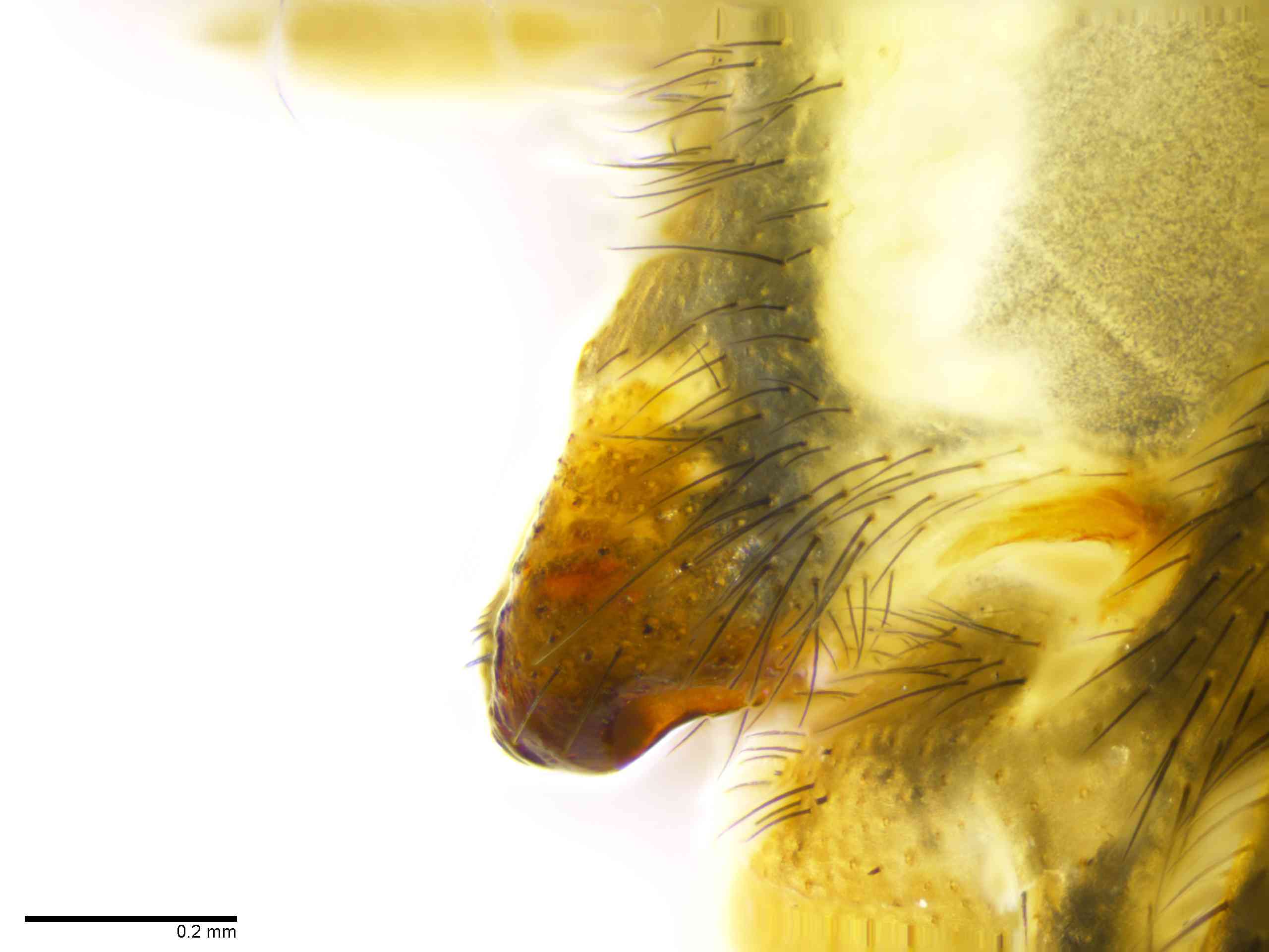 TETRAG0145fpepilTXV309_100X_E2A.jpg