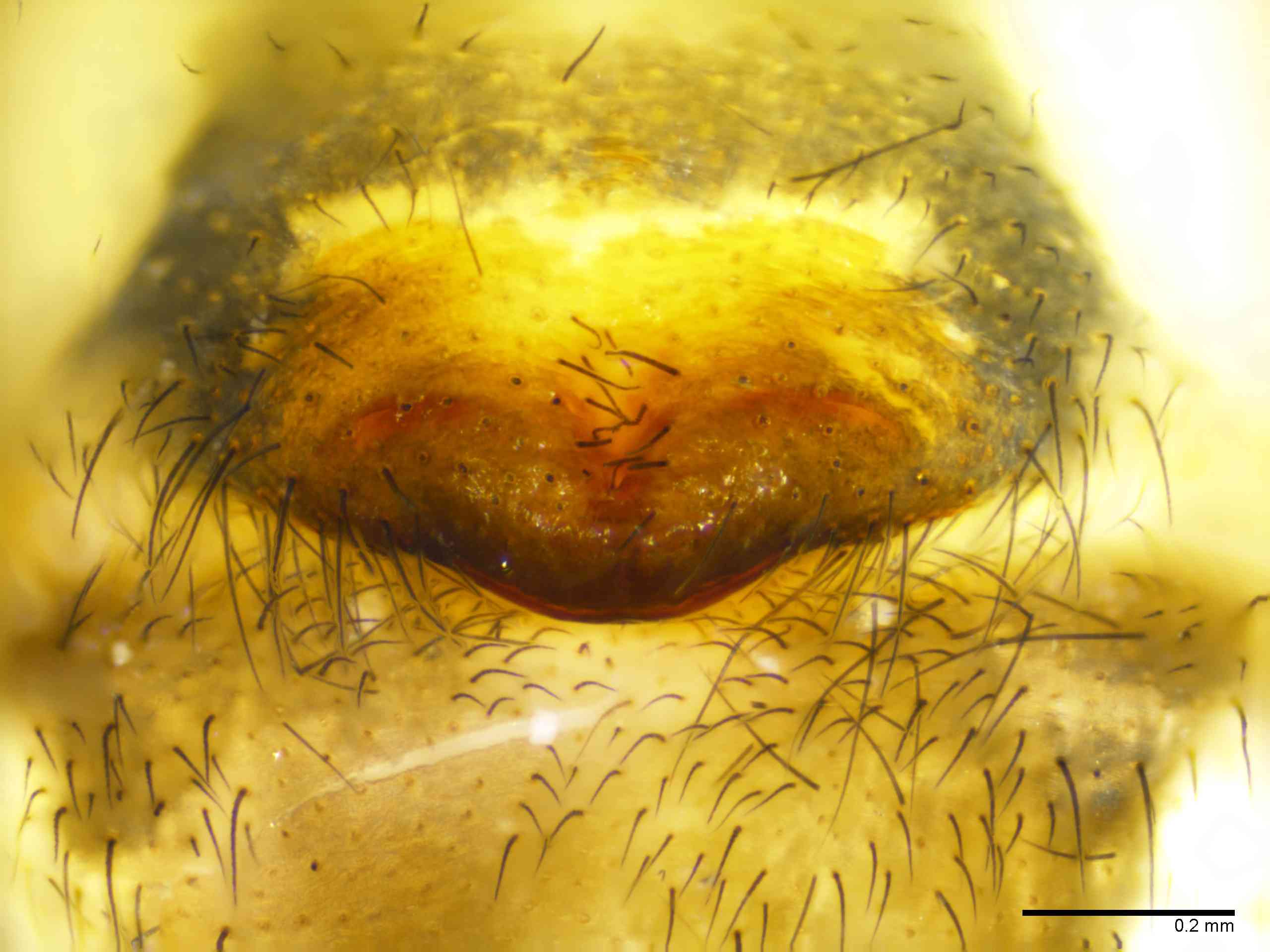 TETRAG0145fpepivTXV309_100X_E2A.jpg