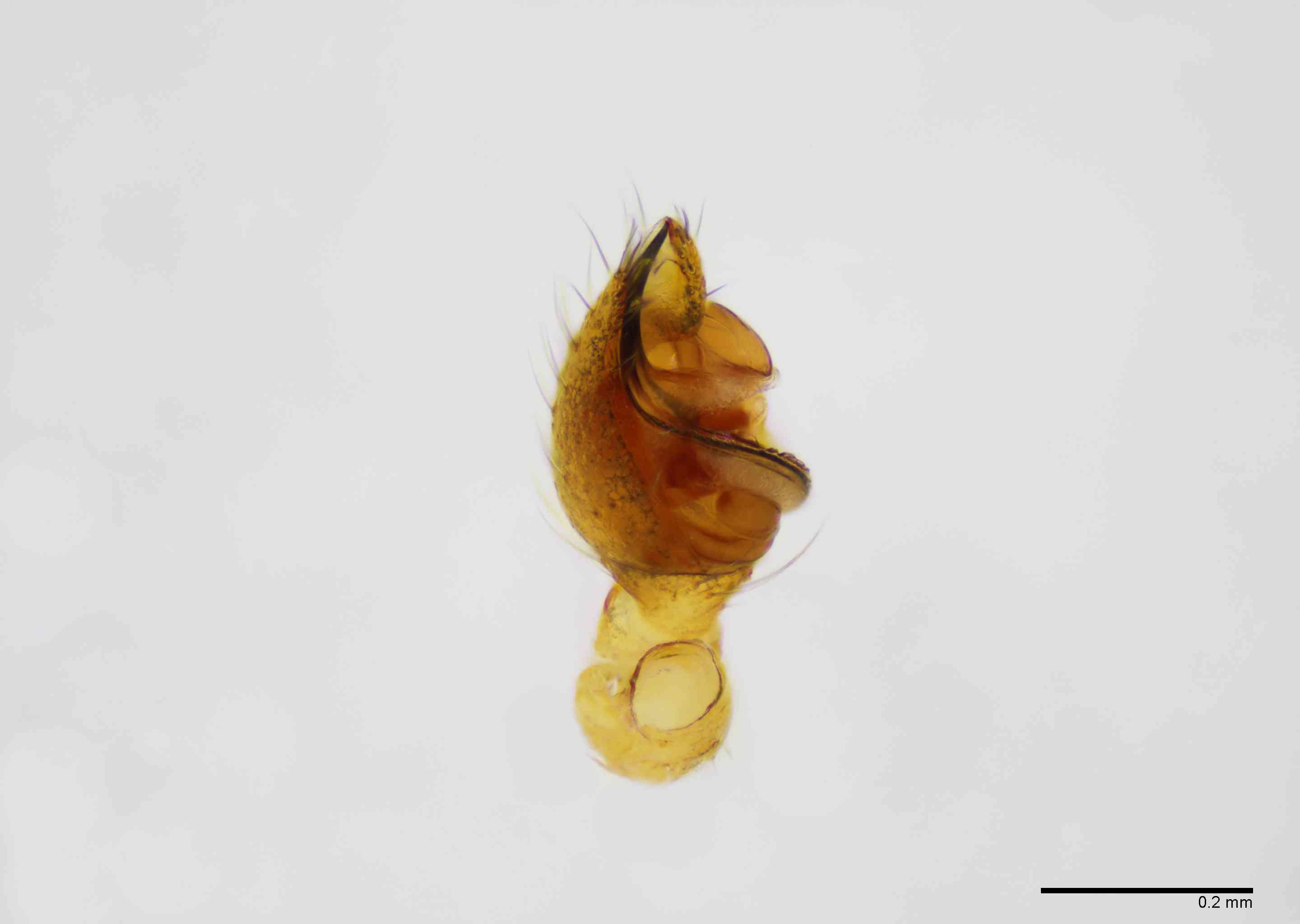 THERID0163mppalpTXV521_100X_Z10.jpg