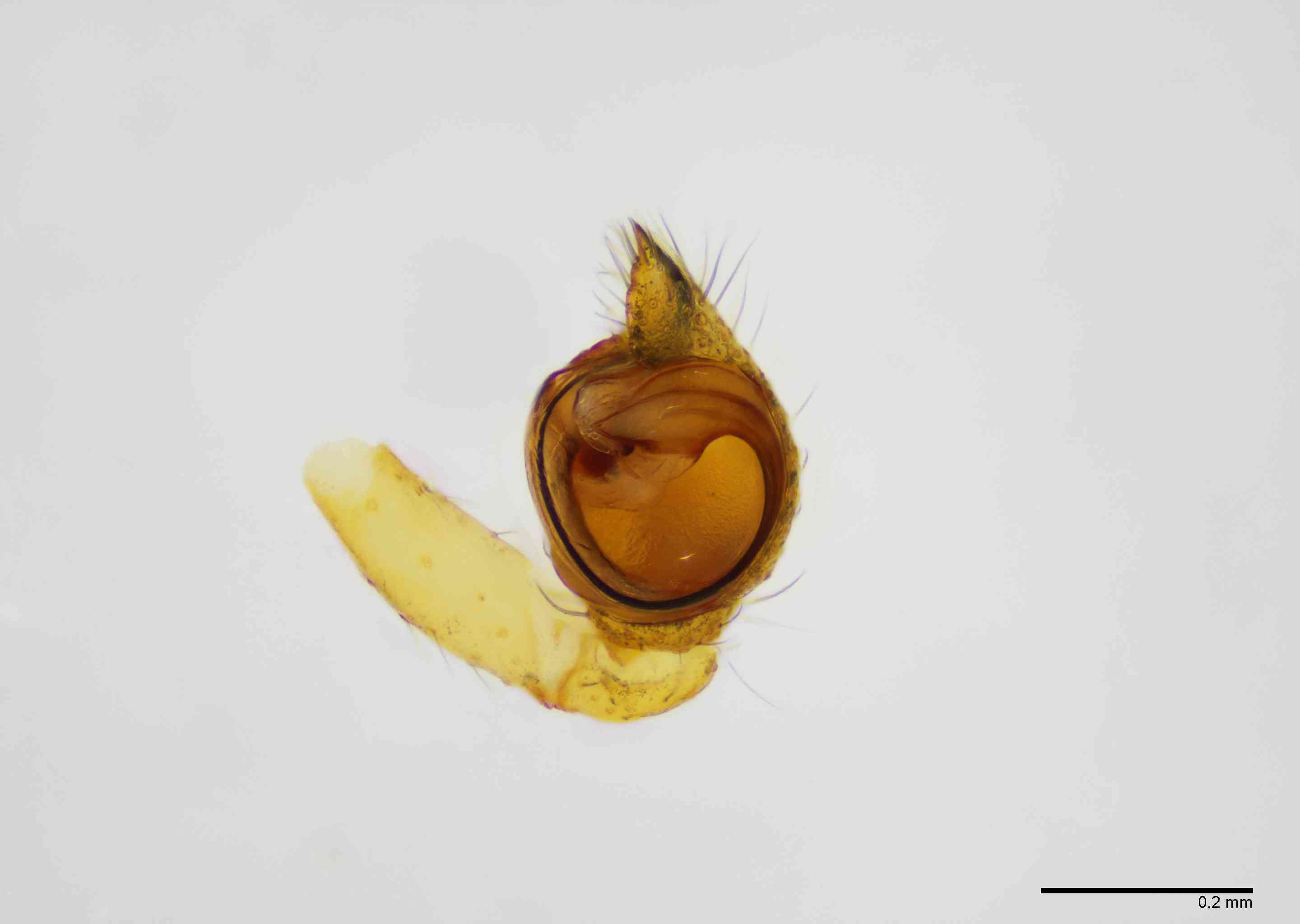 THERID0163mppalvTXV521_100X_Z10.jpg