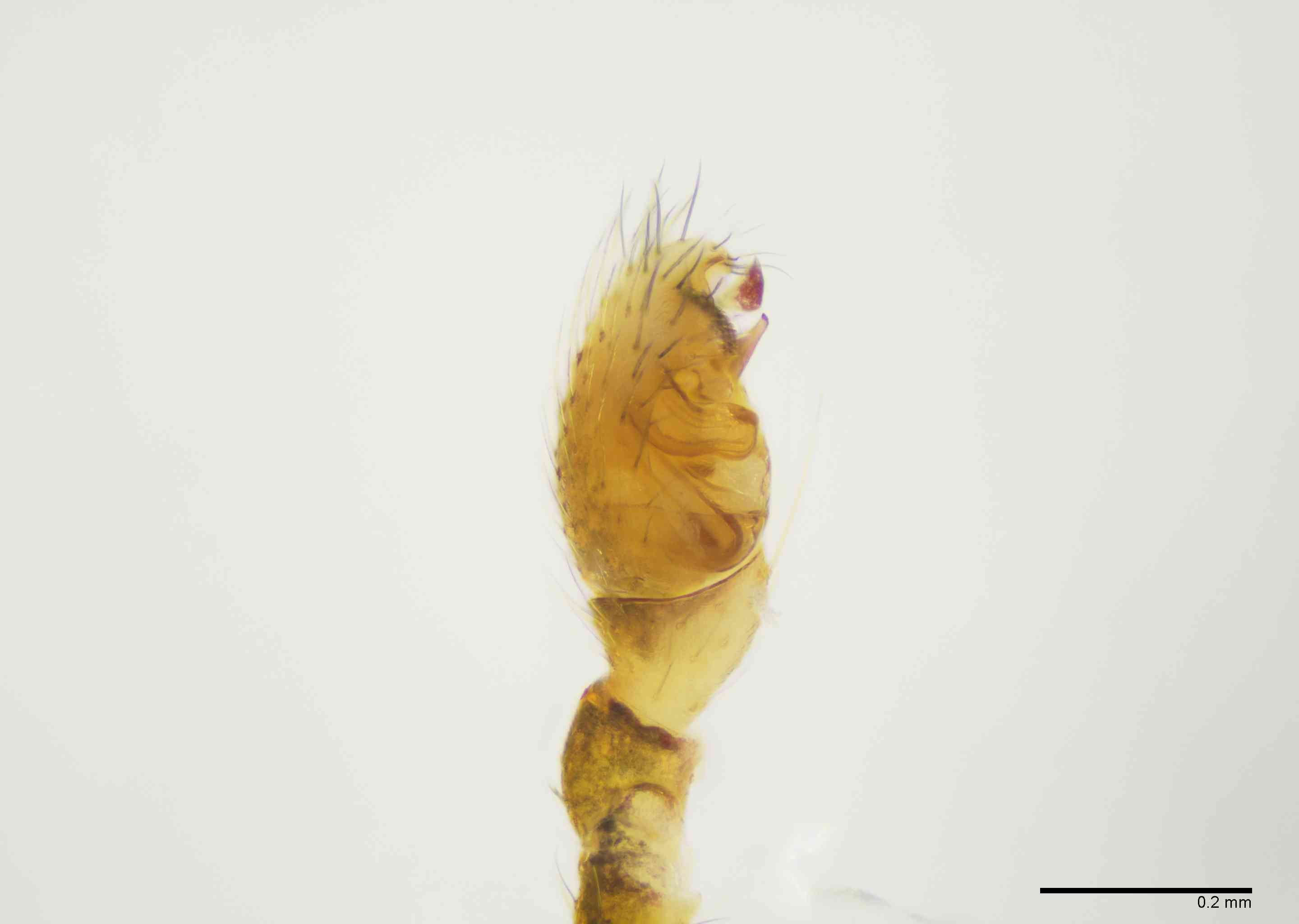 THERID0188mppalpTXV567_100X_E2B.jpg
