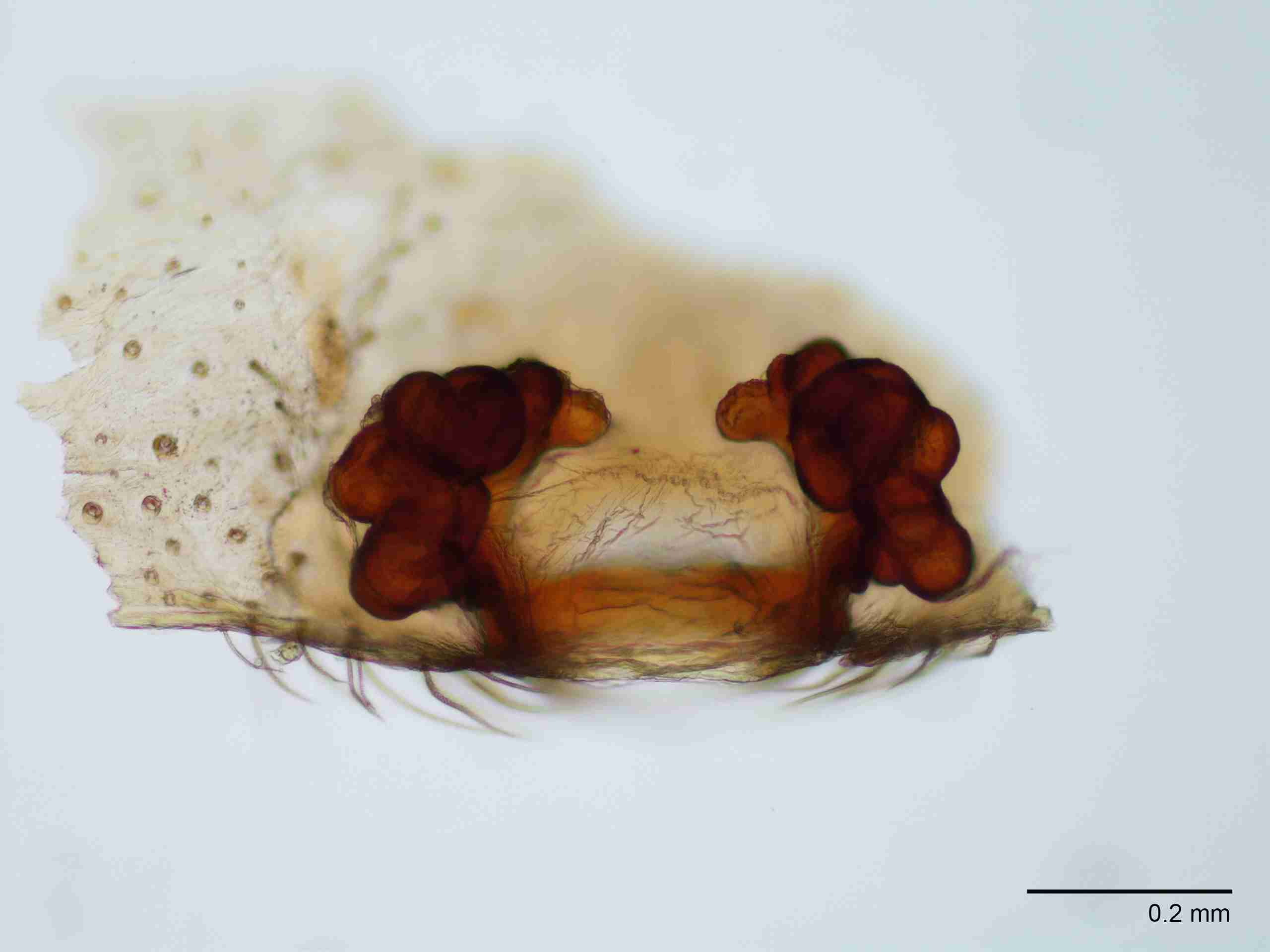 XILAGEL001fpepidJAM267_100X_E2A.jpg