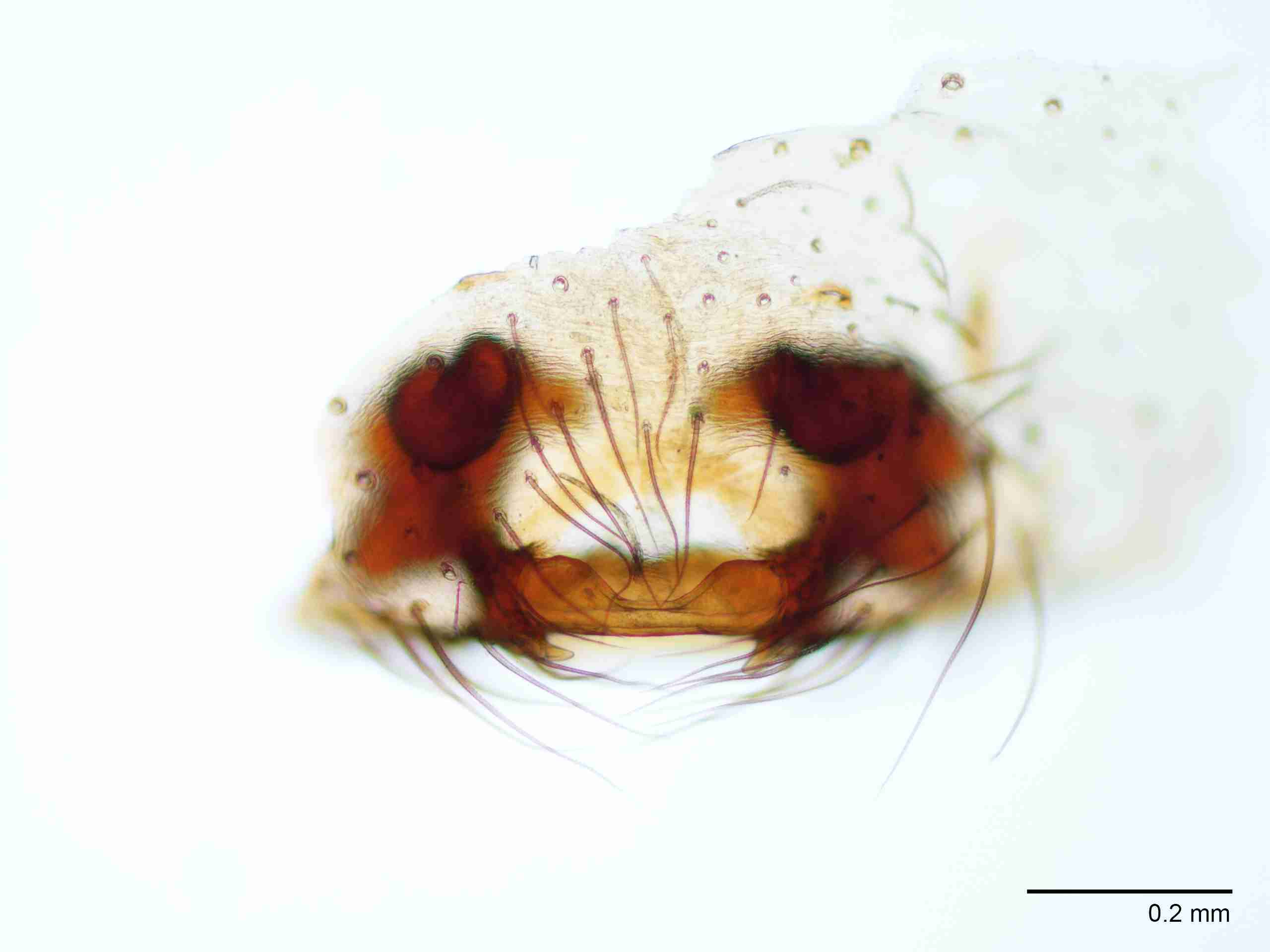 XILAGEL001fpepivJAM267_100X_E2A.jpg