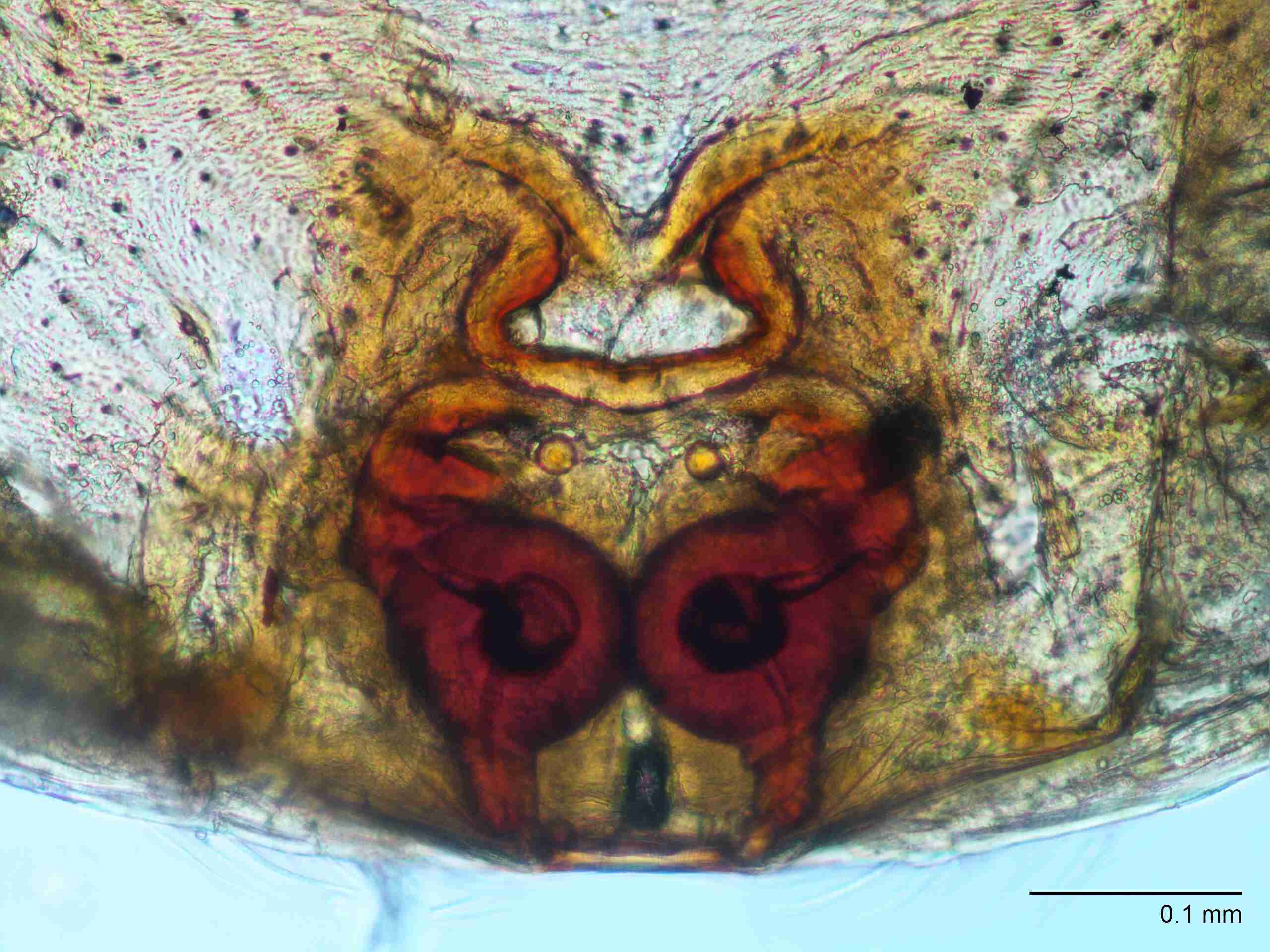 XILANYP004fpepidJAM491_200X_CAS.jpg