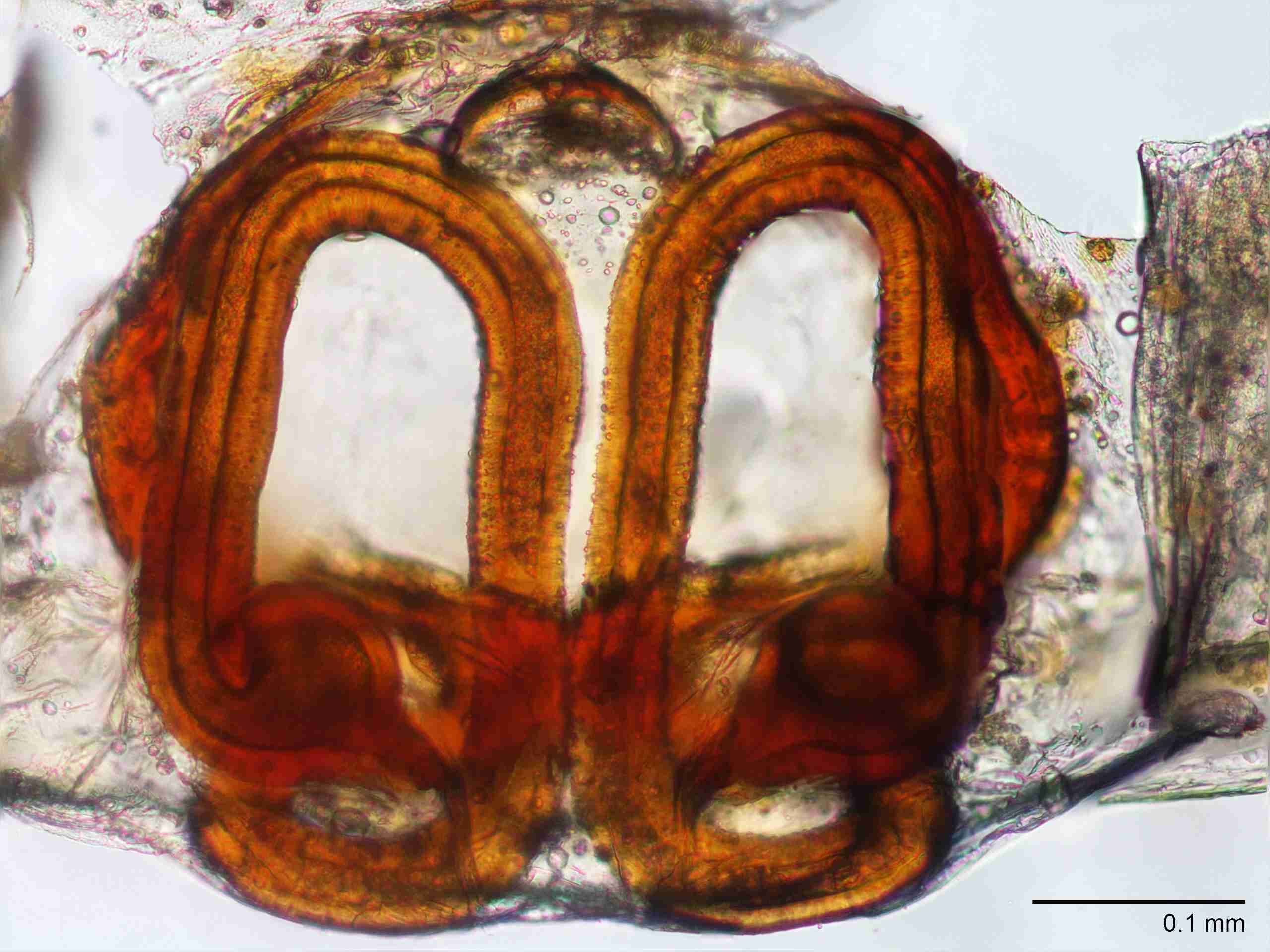 XILANYP006fpepidJAM489_200X_CAS.jpg