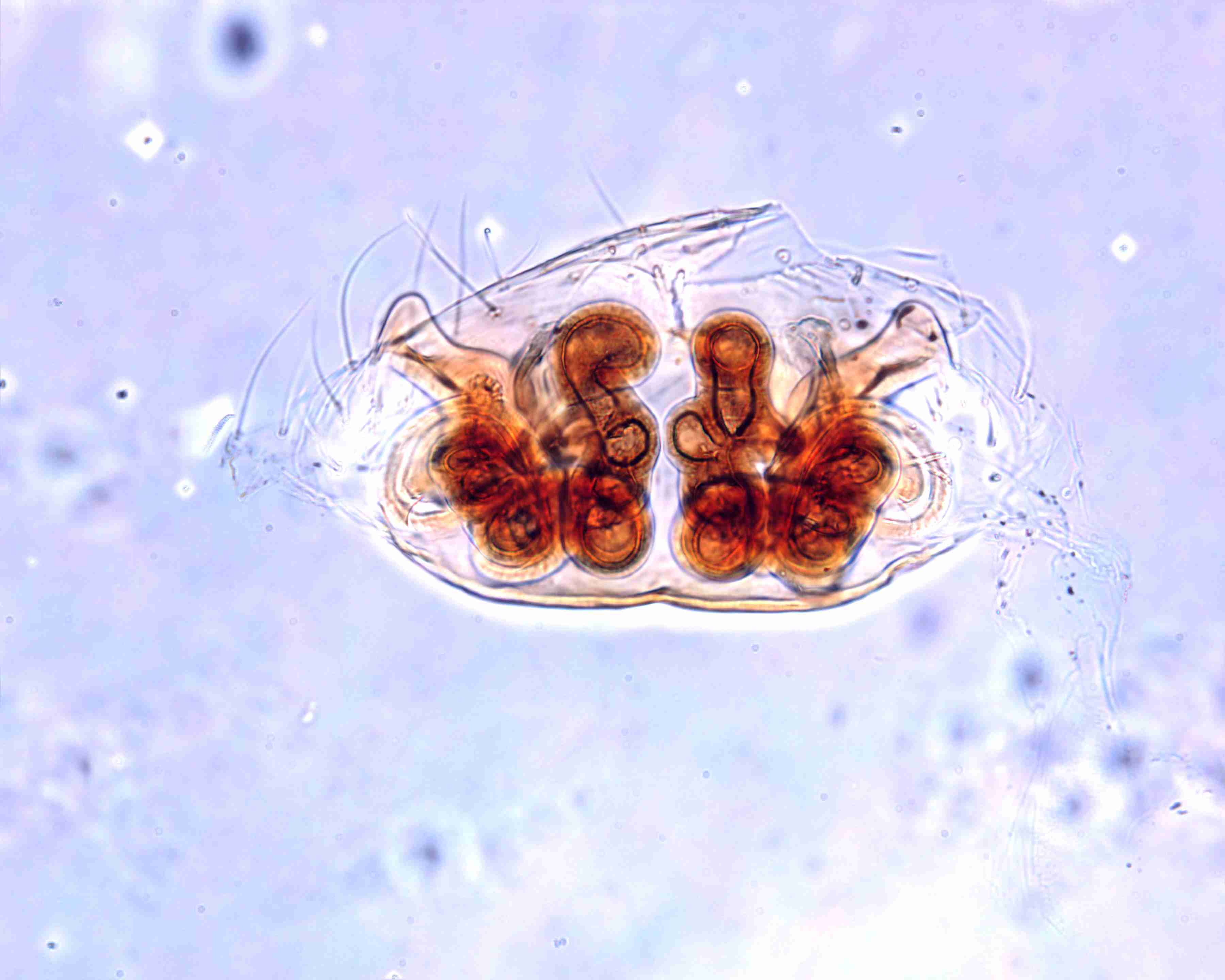 XILANYP007fpepidJAM097_115X_CAS.jpg
