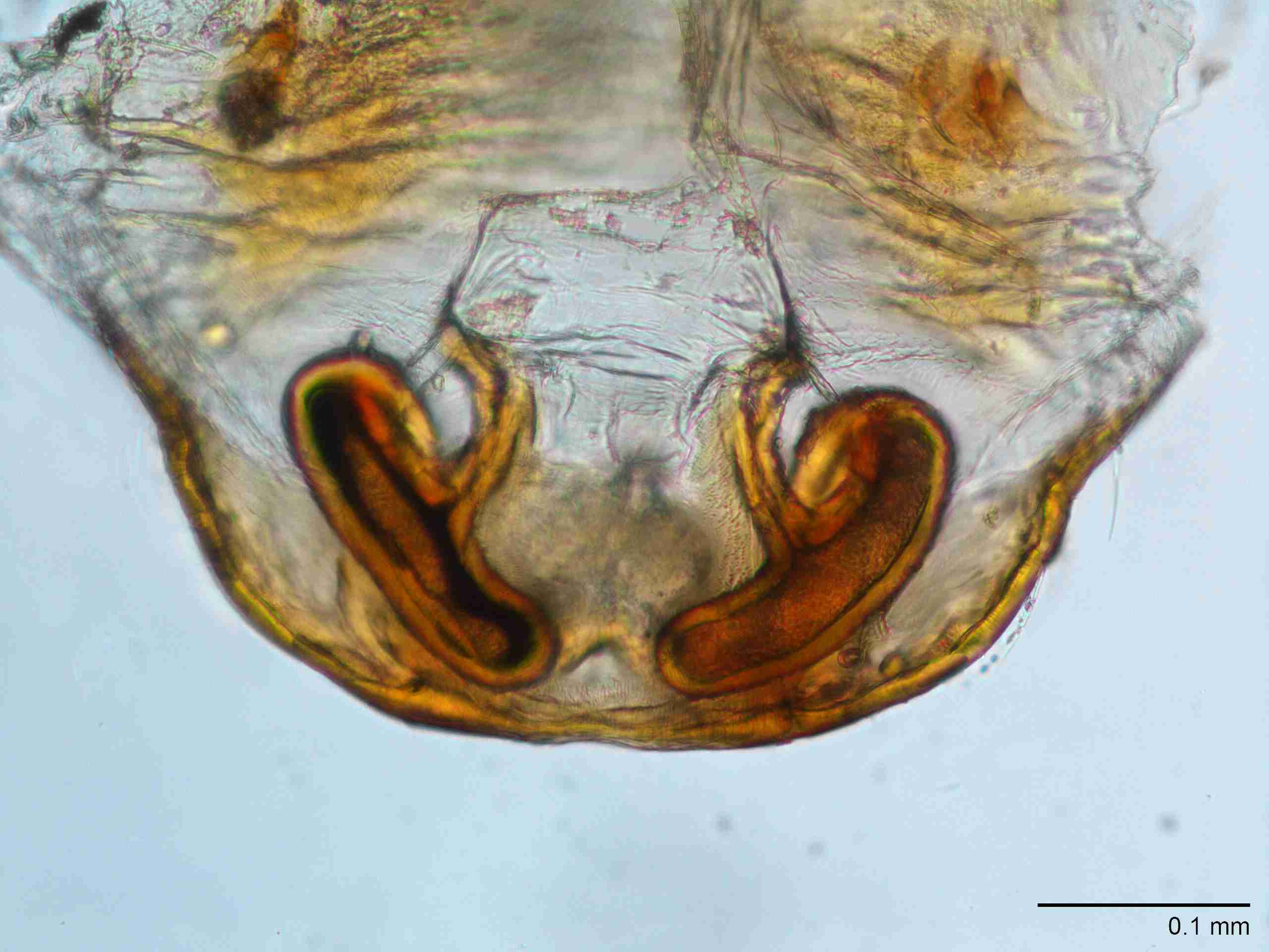 XILANYP008fpepidJAM185_200X_CAS.jpg