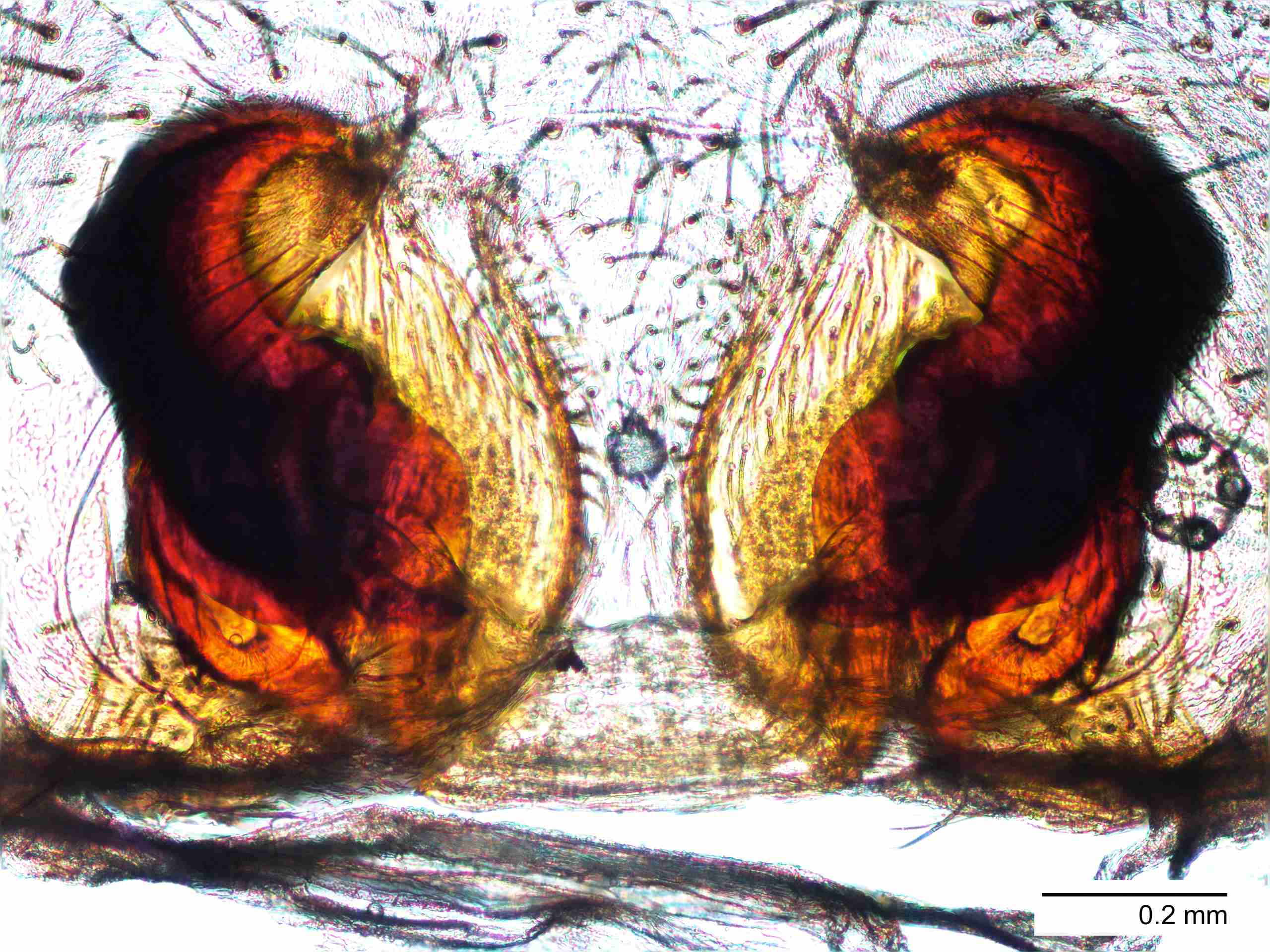 XILCTEN050fpepidJAM871_100X_E2A.jpg
