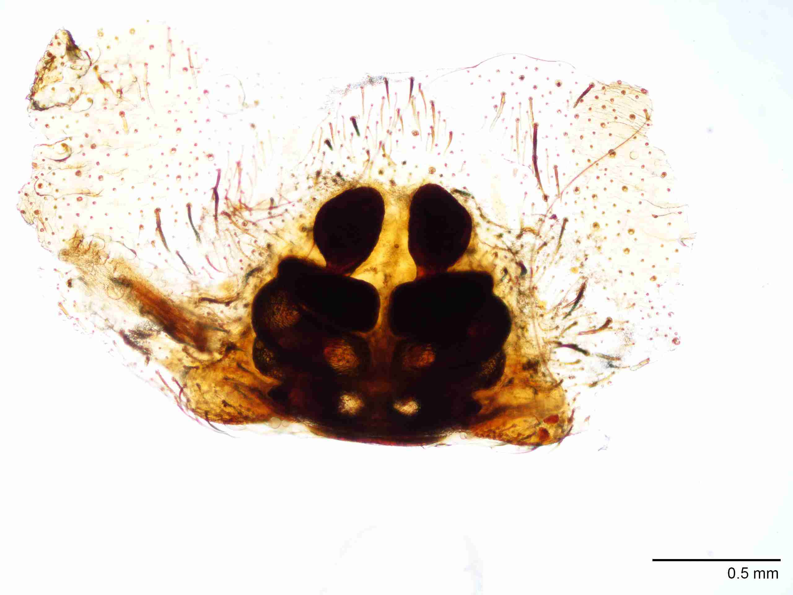 XILDEIN051fpepidJAM029_40X_Z10.jpg