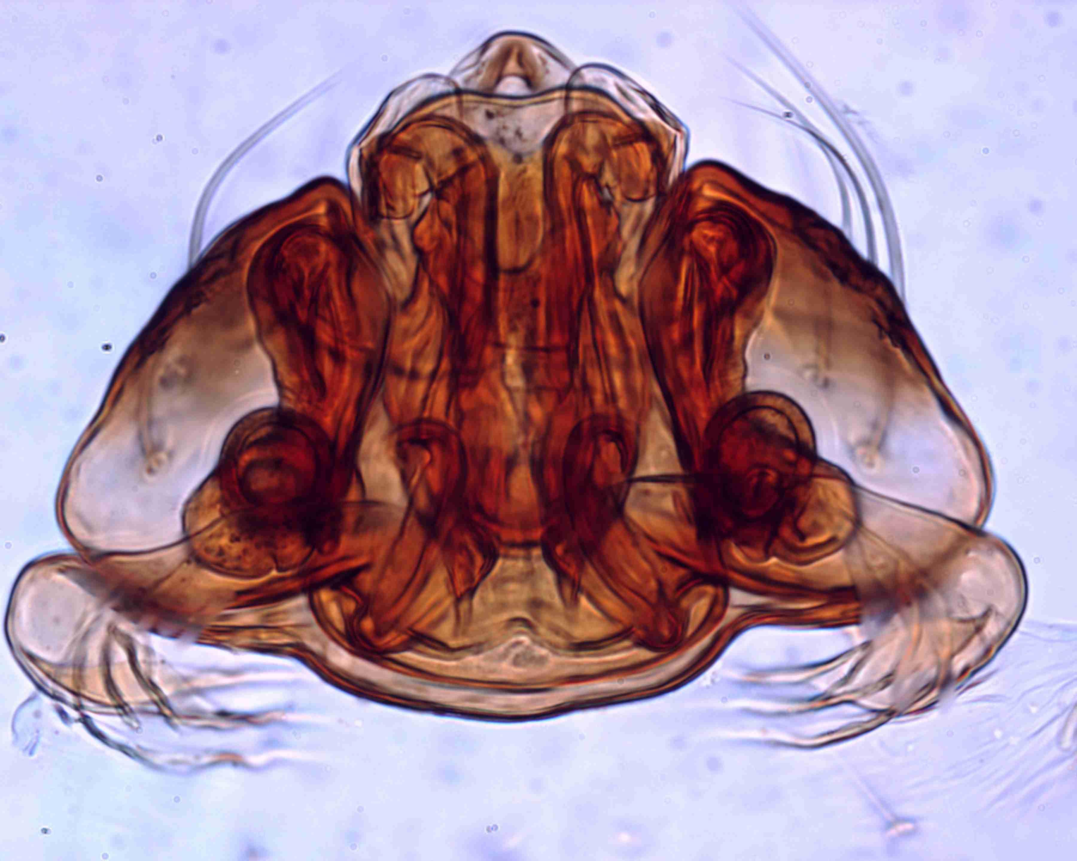 XILLINY064fpepidJAM341_400X_CAS.jpg