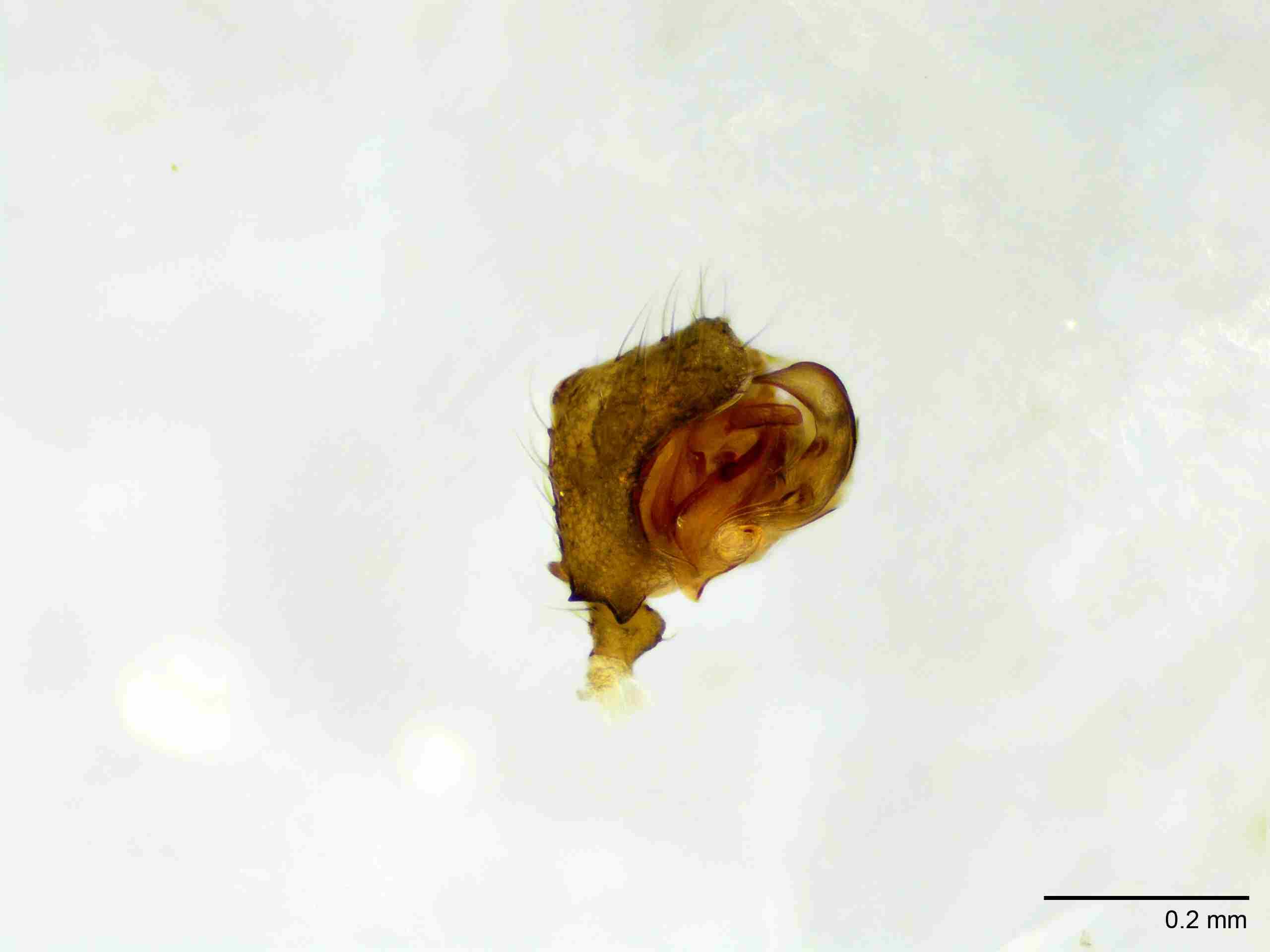 XILLINY064mppalpJAM897_100X_E2A.jpg