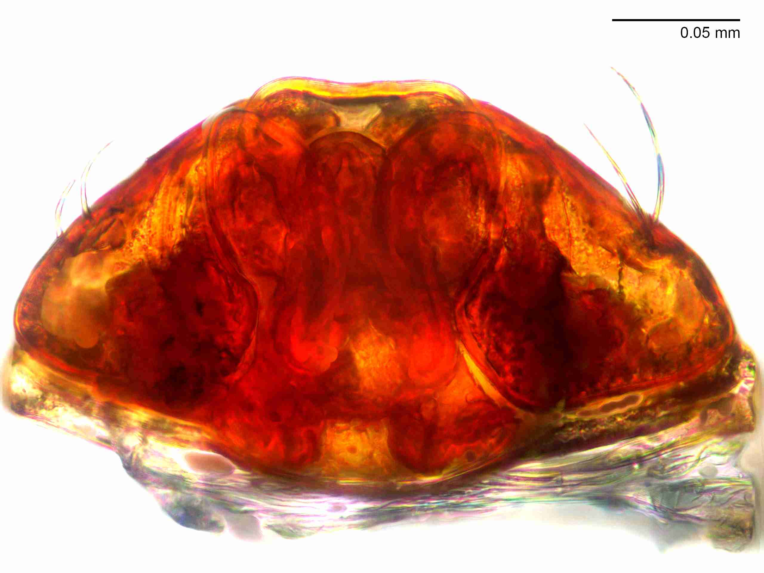 XILLINY065fpepidJAM021_400X_E2A.jpg