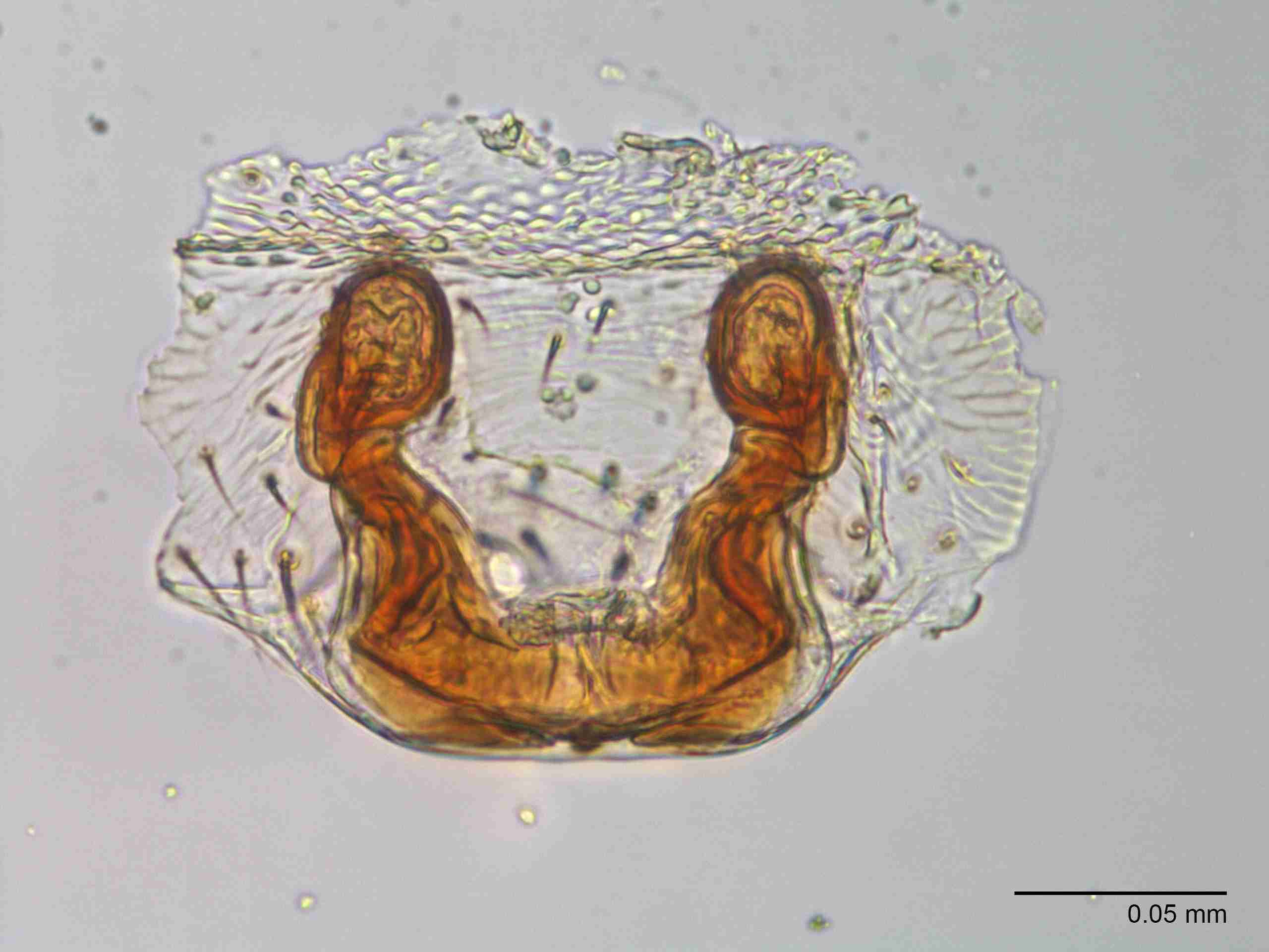 XILLINY067fpepidJAM904_400X_E2A.jpg