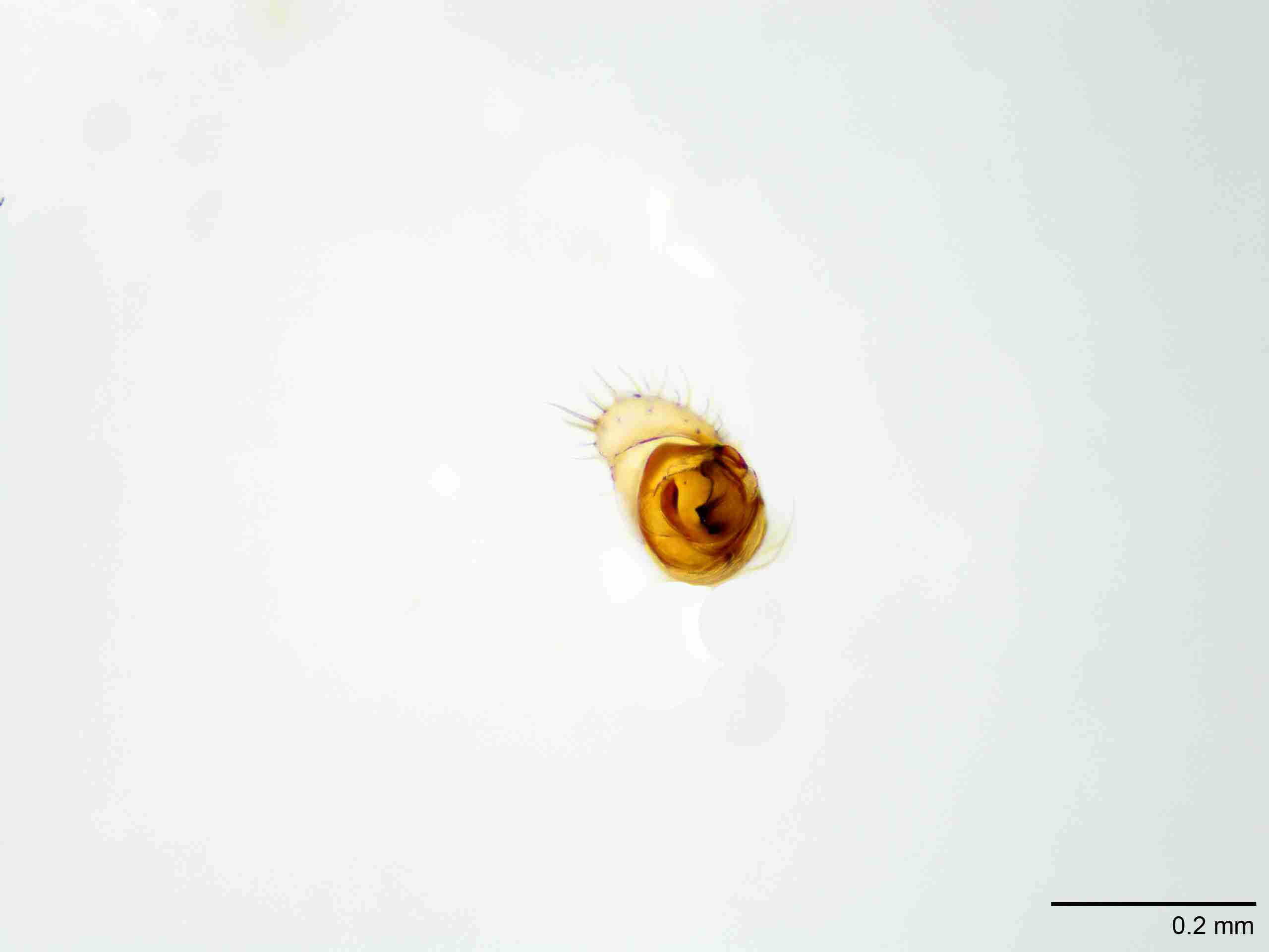 XILLINY067mppalaJAM905_100X_E2A.jpg